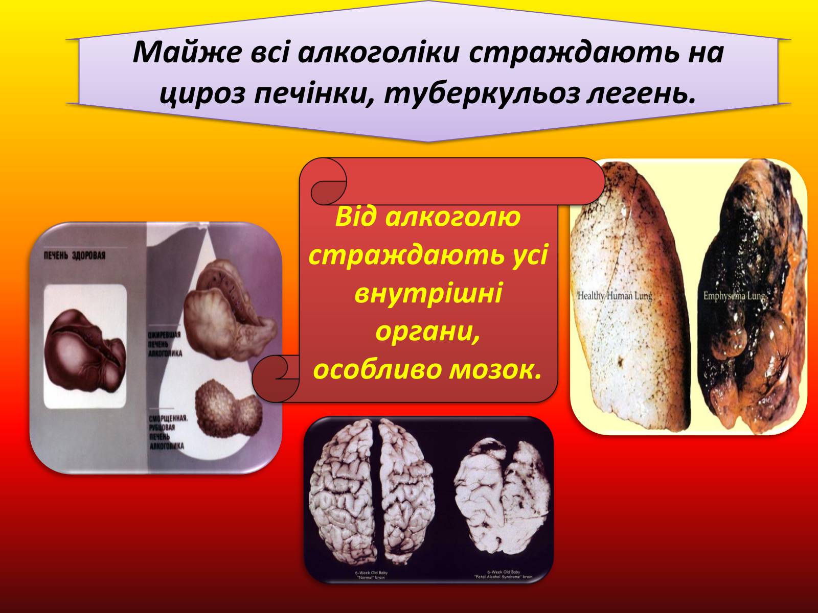 Презентація на тему «Вплив куріння та алкоголю на здоров’я» - Слайд #14 Презентація на тему «Вплив куріння та алкоголю на здоров’я» - Слайд #14
