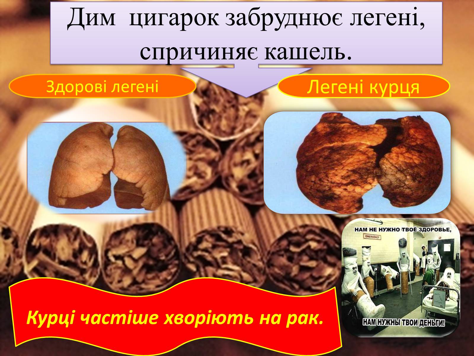 Презентація на тему «Вплив куріння та алкоголю на здоров’я» - Слайд #5 Презентація на тему «Вплив куріння та алкоголю на здоров’я» - Слайд #5