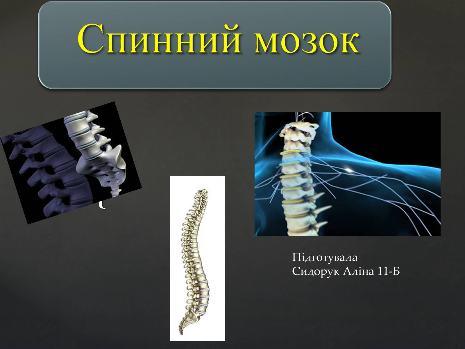 Презентація на тему «Спинний мозок» (варіант 2) - Слайд #1 Презентація на тему «Спинний мозок» (варіант 2) - Слайд #1