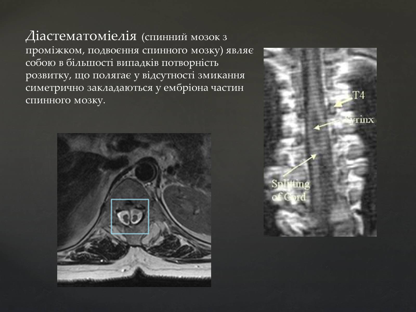 Презентація на тему «Спинний мозок» (варіант 2) - Слайд #18 Презентація на тему «Спинний мозок» (варіант 2) - Слайд #18
