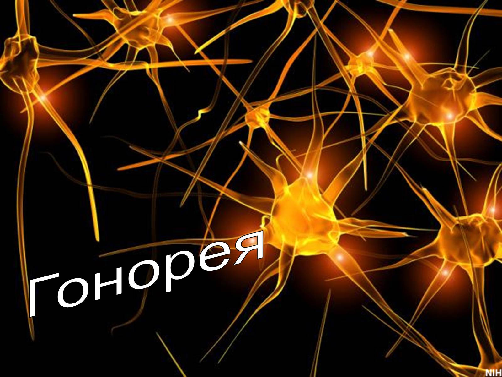 Презентація на тему «Гонорея» - Слайд #1 Презентація на тему «Гонорея» - Слайд #1