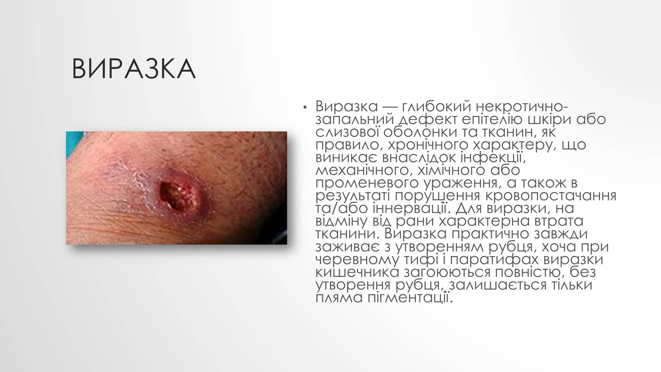 Презентація на тему «Шкірні захворювання» - Слайд #4 Презентація на тему «Шкірні захворювання» - Слайд #4