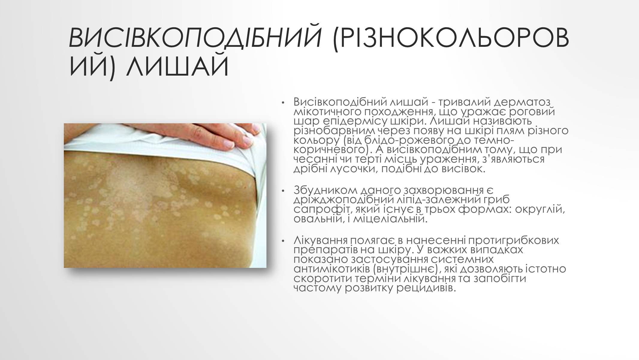 Презентація на тему «Шкірні захворювання» - Слайд #5 Презентація на тему «Шкірні захворювання» - Слайд #5