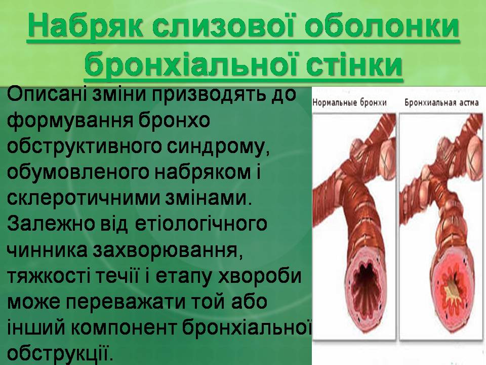 Презентація на тему «Бронхіальна астма» - Слайд #12 Презентація на тему «Бронхіальна астма» - Слайд #12