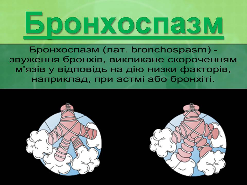 Презентація на тему «Бронхіальна астма» - Слайд #4 Презентація на тему «Бронхіальна астма» - Слайд #4
