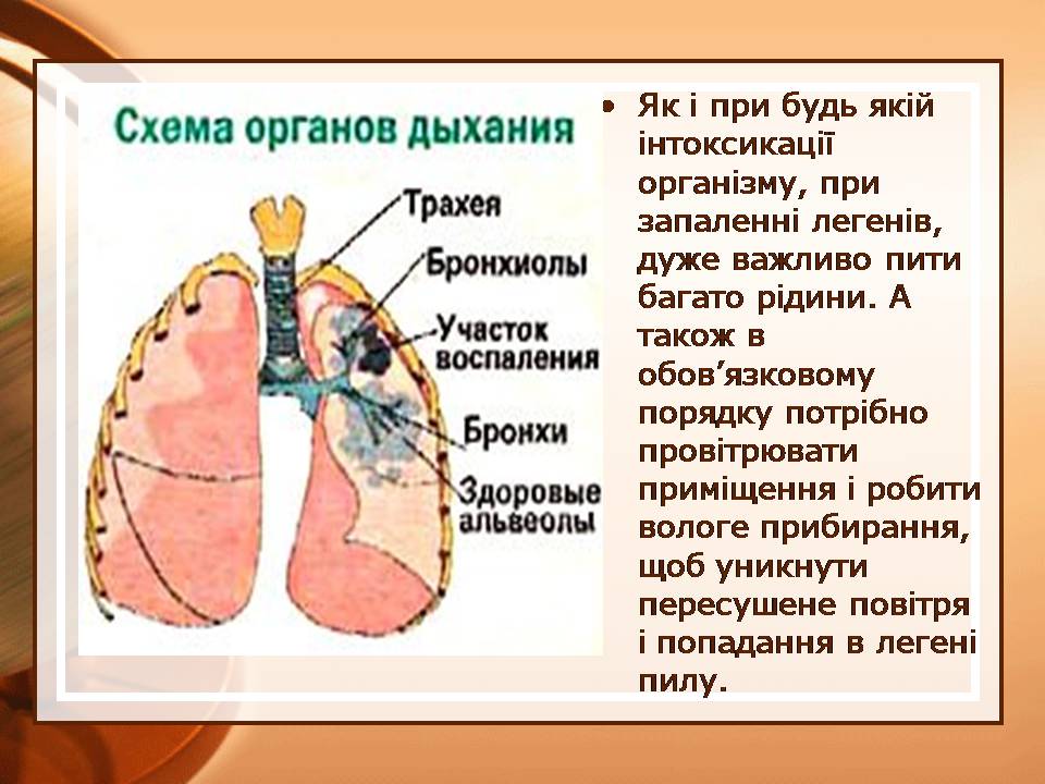 Презентація на тему «Пневмонія» - Слайд #10 Презентація на тему «Пневмонія» - Слайд #10