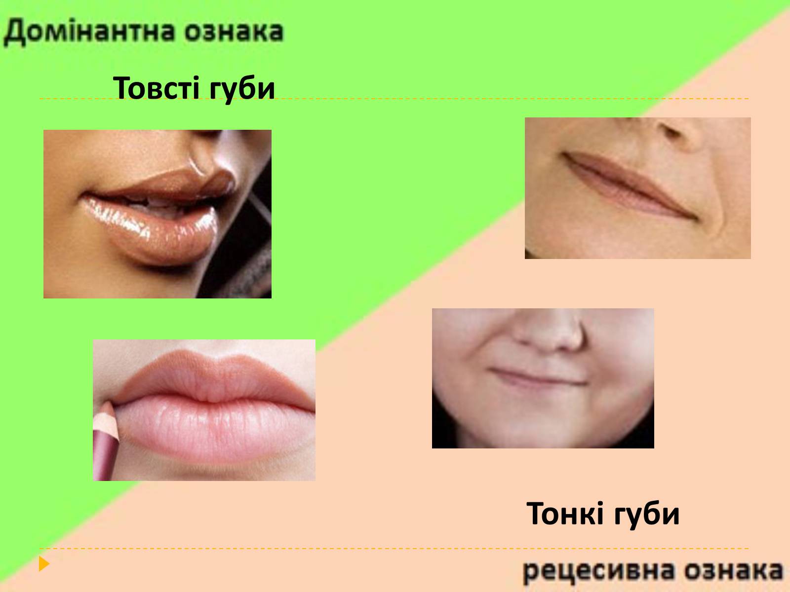 Презентація на тему «Домінантні та рецесивні стани ознак у людини» - Слайд #10 Презентація на тему «Домінантні та рецесивні стани ознак у людини» - Слайд #10