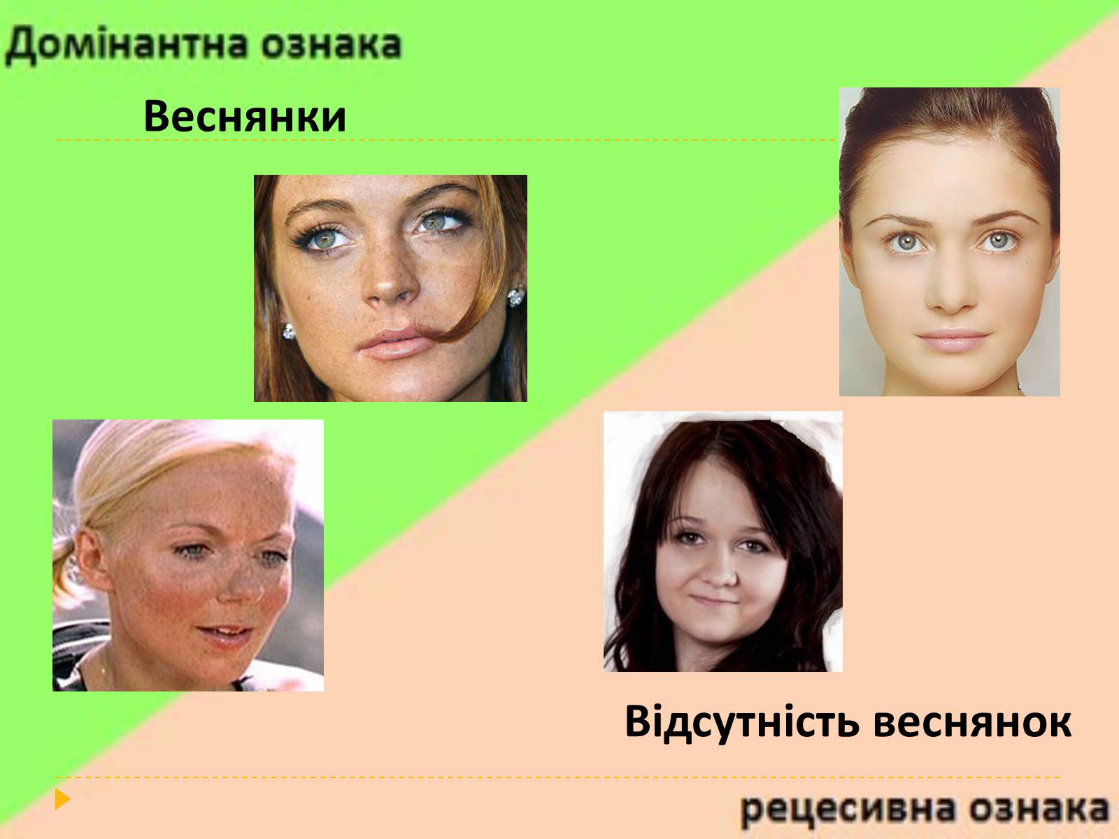 Презентація на тему «Домінантні та рецесивні стани ознак у людини» - Слайд #14 Презентація на тему «Домінантні та рецесивні стани ознак у людини» - Слайд #14