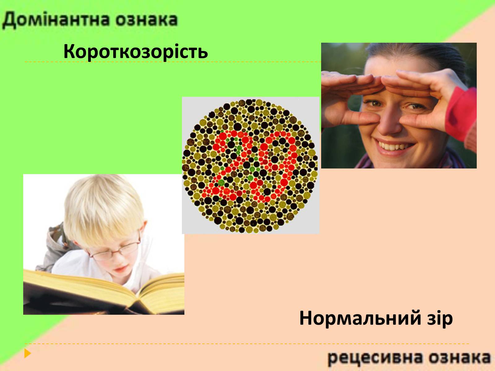 Презентація на тему «Домінантні та рецесивні стани ознак у людини» - Слайд #7 Презентація на тему «Домінантні та рецесивні стани ознак у людини» - Слайд #7