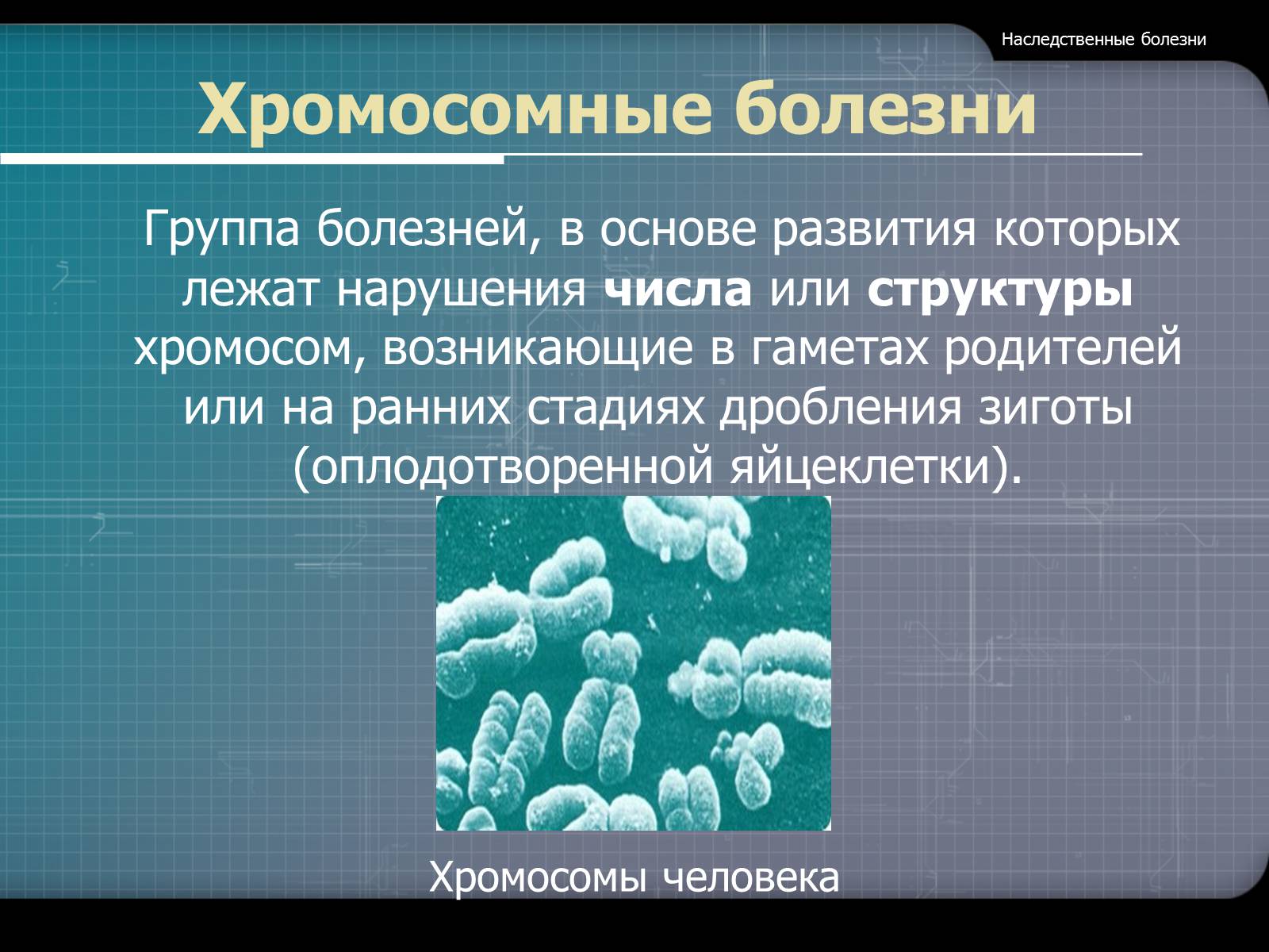 Презентація на тему «Наследственные болезни» - Слайд #15