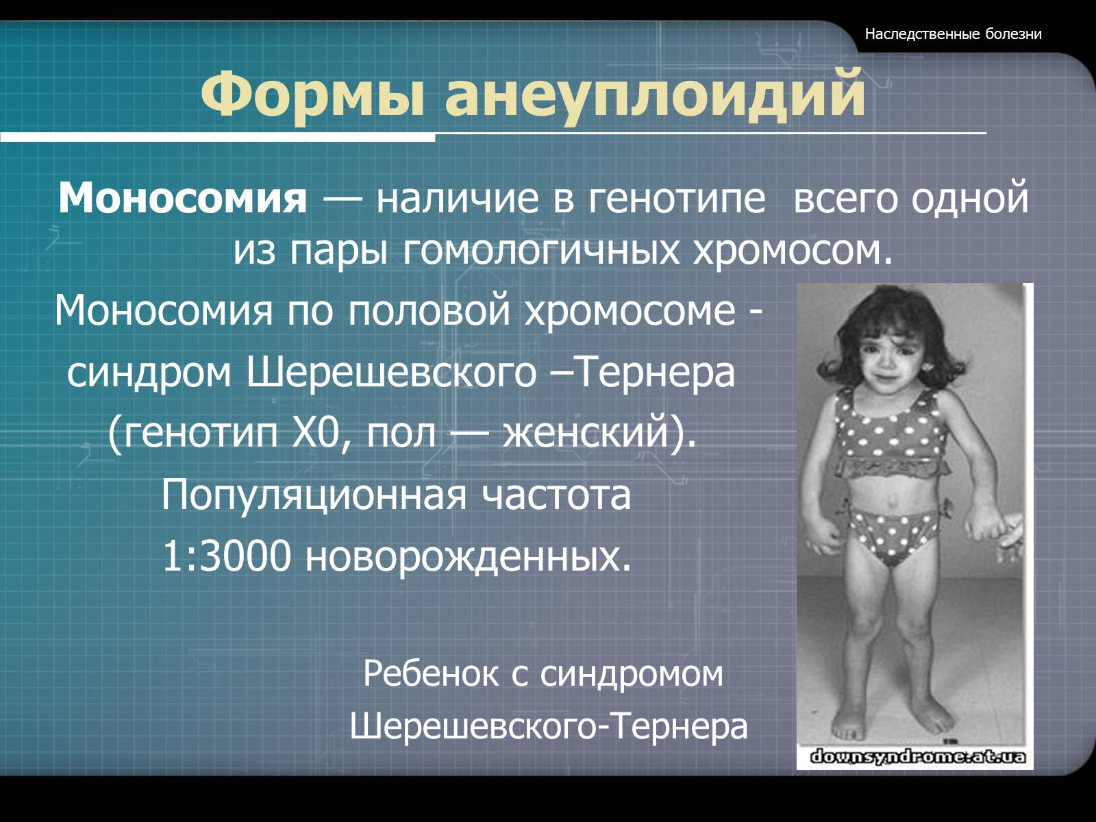 Презентація на тему «Наследственные болезни» - Слайд #18