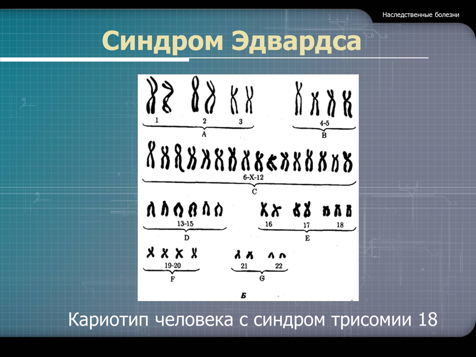 Презентація на тему «Наследственные болезни» - Слайд #20