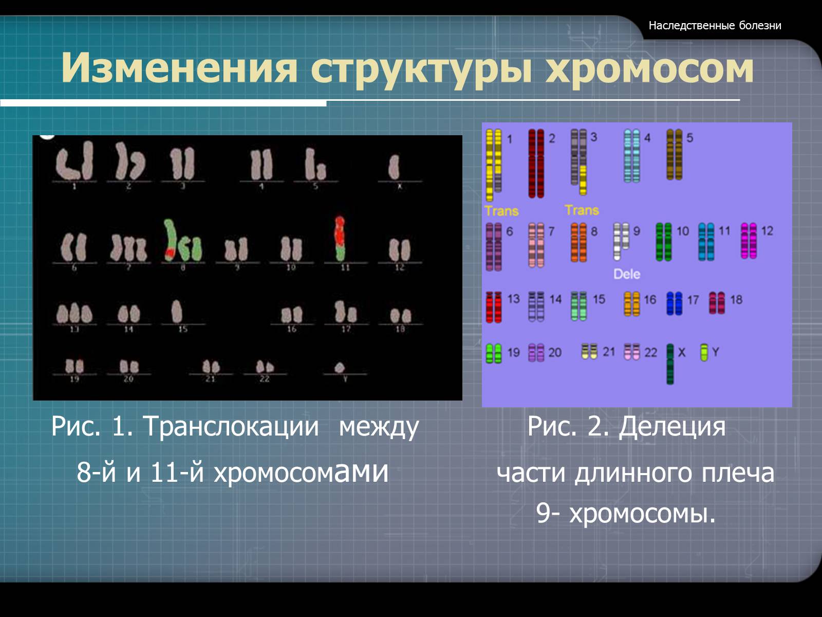 Презентація на тему «Наследственные болезни» - Слайд #23