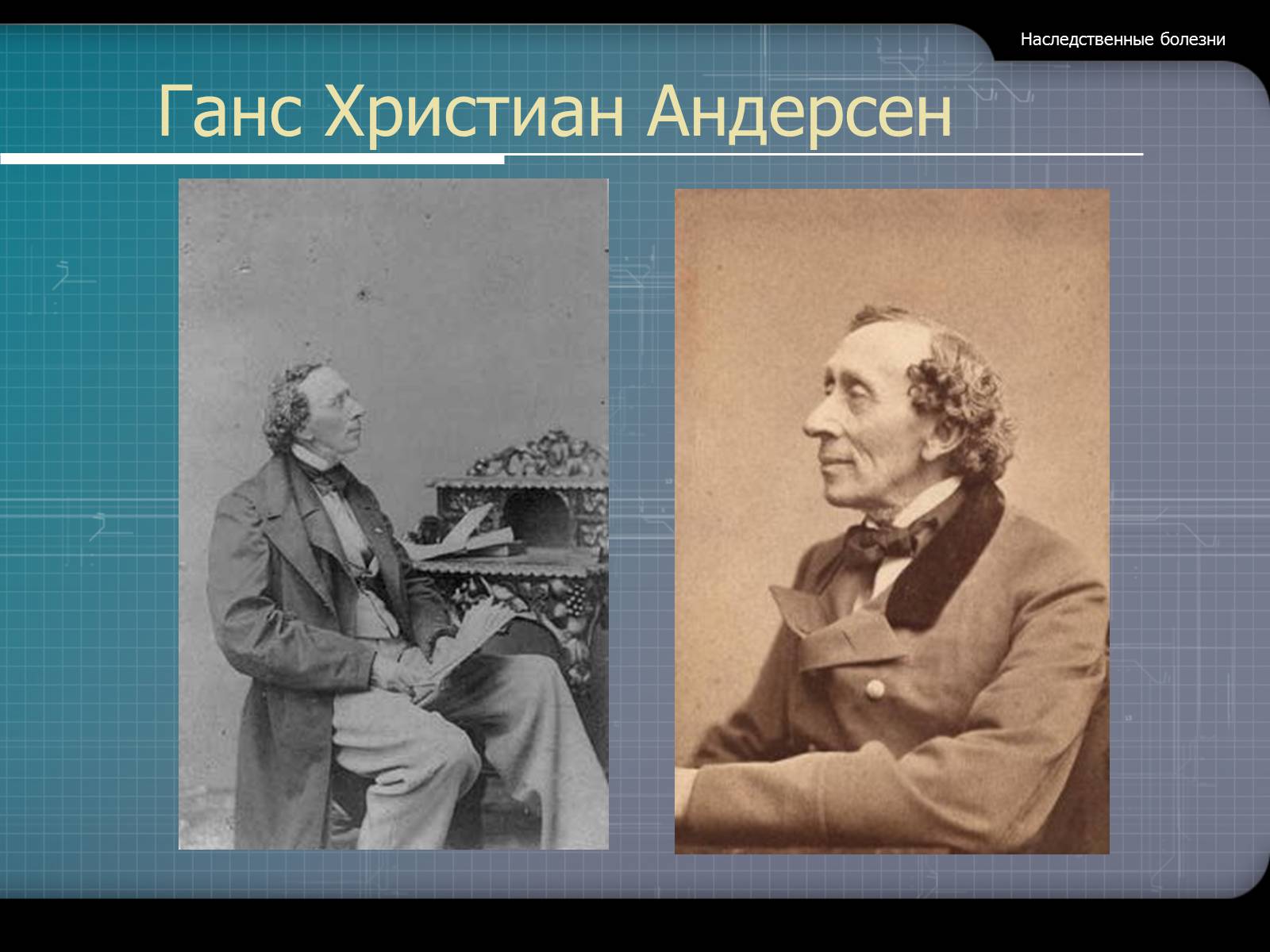 Презентація на тему «Наследственные болезни» - Слайд #26