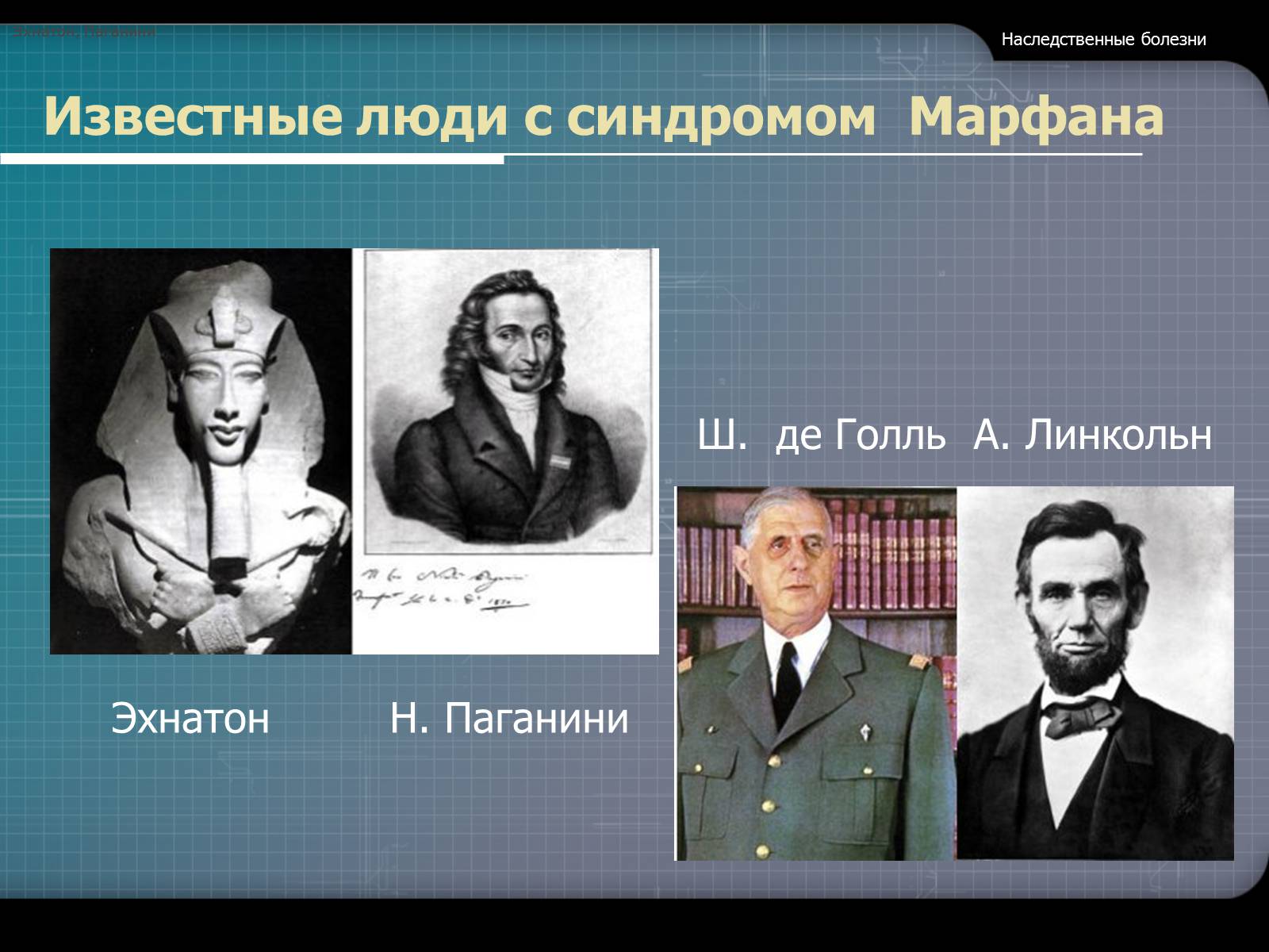 Презентація на тему «Наследственные болезни» - Слайд #8
