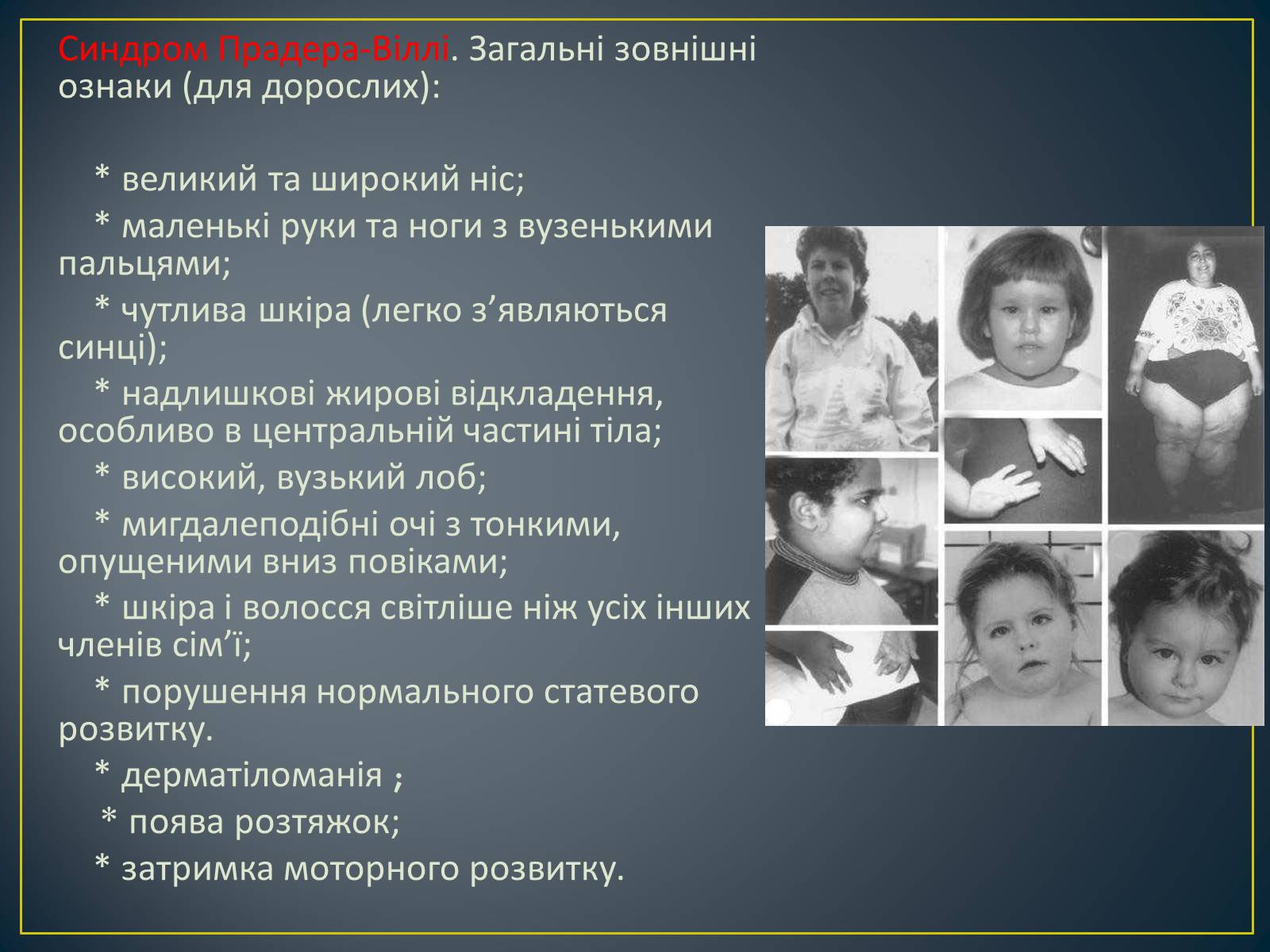 Презентація на тему «Генетика людини» (варіант 5) - Слайд #11 Презентація на тему «Генетика людини» (варіант 5) - Слайд #11