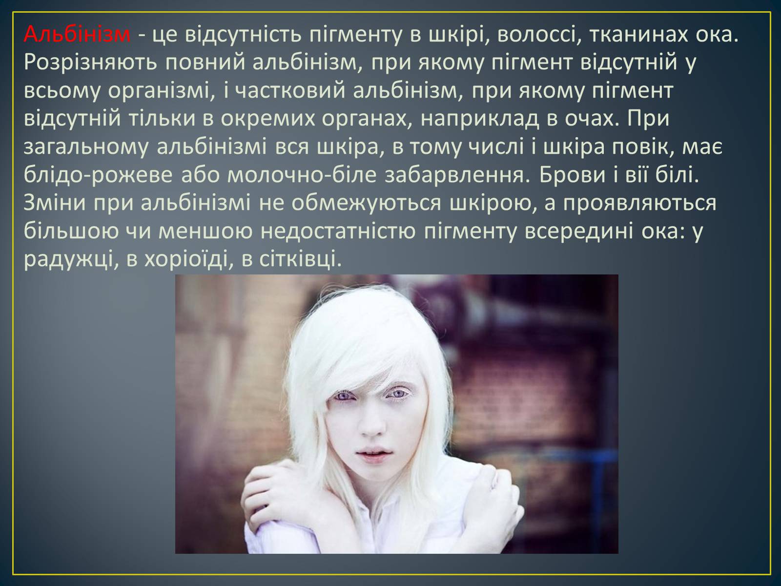 Презентація на тему «Генетика людини» (варіант 5) - Слайд #13 Презентація на тему «Генетика людини» (варіант 5) - Слайд #13