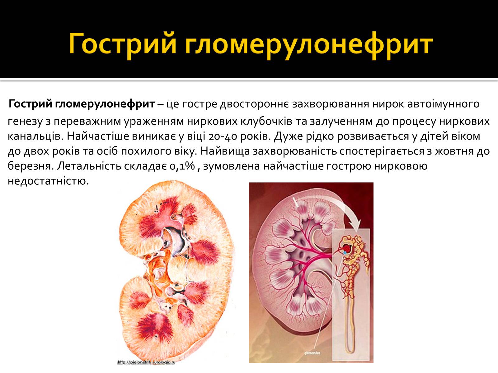 Презентація на тему «Захворювання нирок та сечовивідних шляхів» - Слайд #2 Презентація на тему «Захворювання нирок та сечовивідних шляхів» - Слайд #2