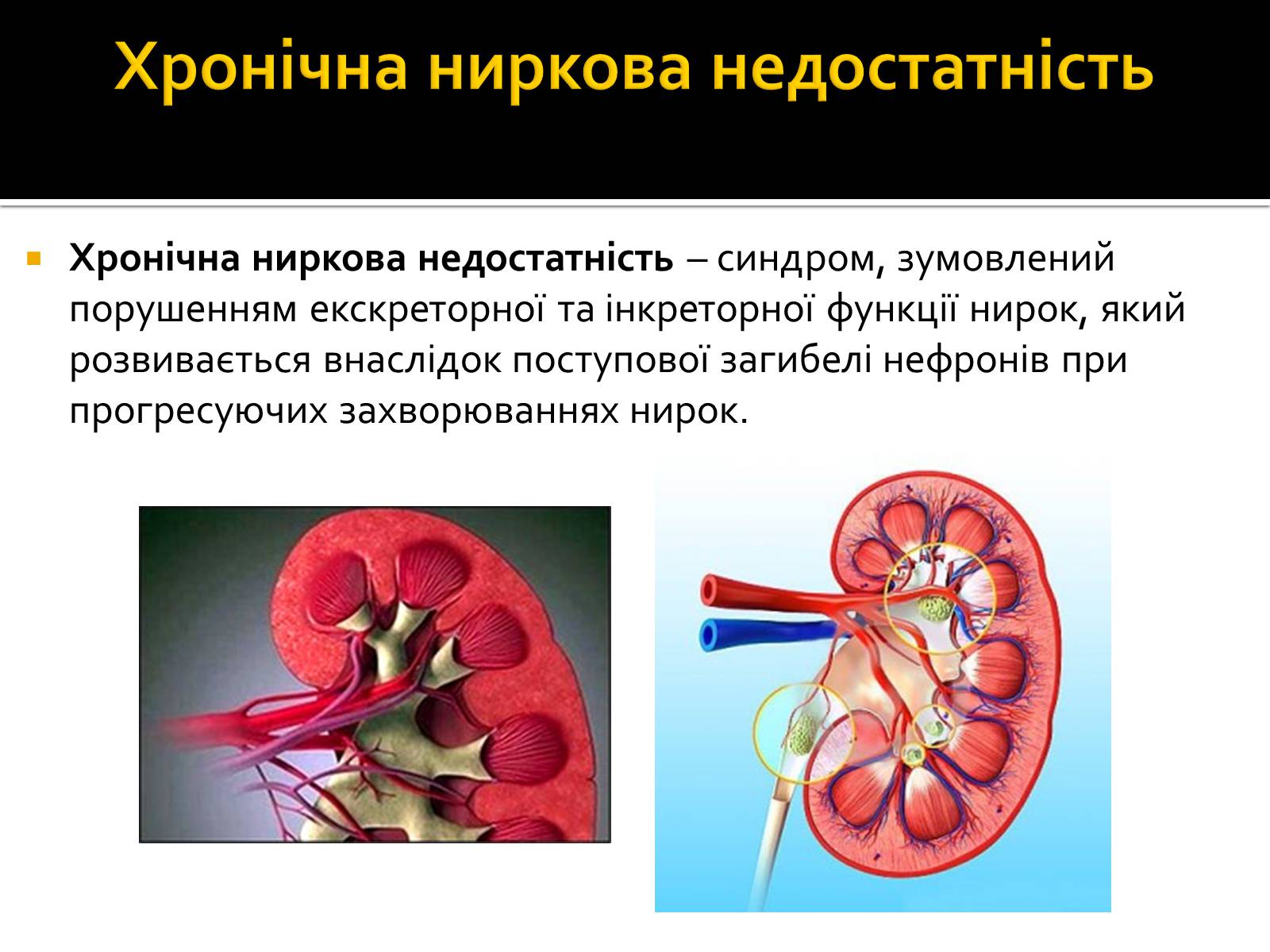 Презентація на тему «Захворювання нирок та сечовивідних шляхів» - Слайд #6 Презентація на тему «Захворювання нирок та сечовивідних шляхів» - Слайд #6