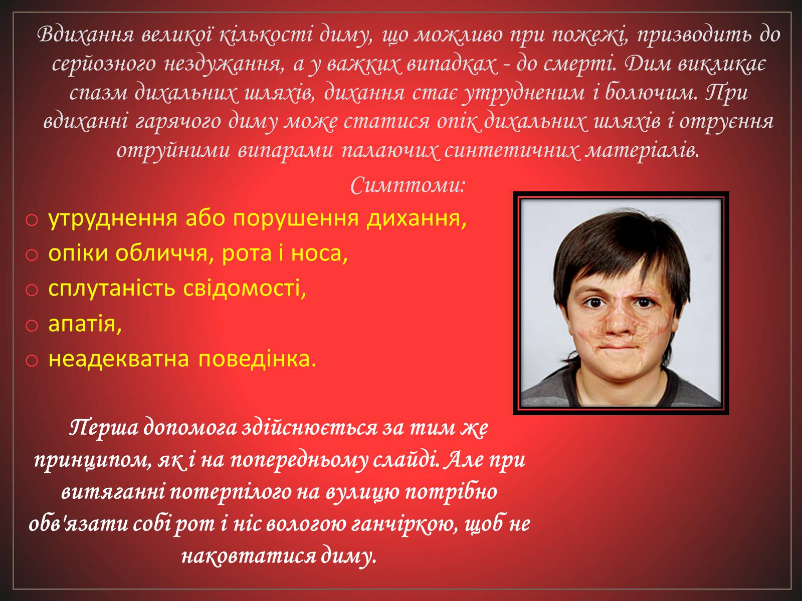 Презентація на тему «Перша допомога при отруєннях» (варіант 2) - Слайд #18 Презентація на тему «Перша допомога при отруєннях» (варіант 2) - Слайд #18
