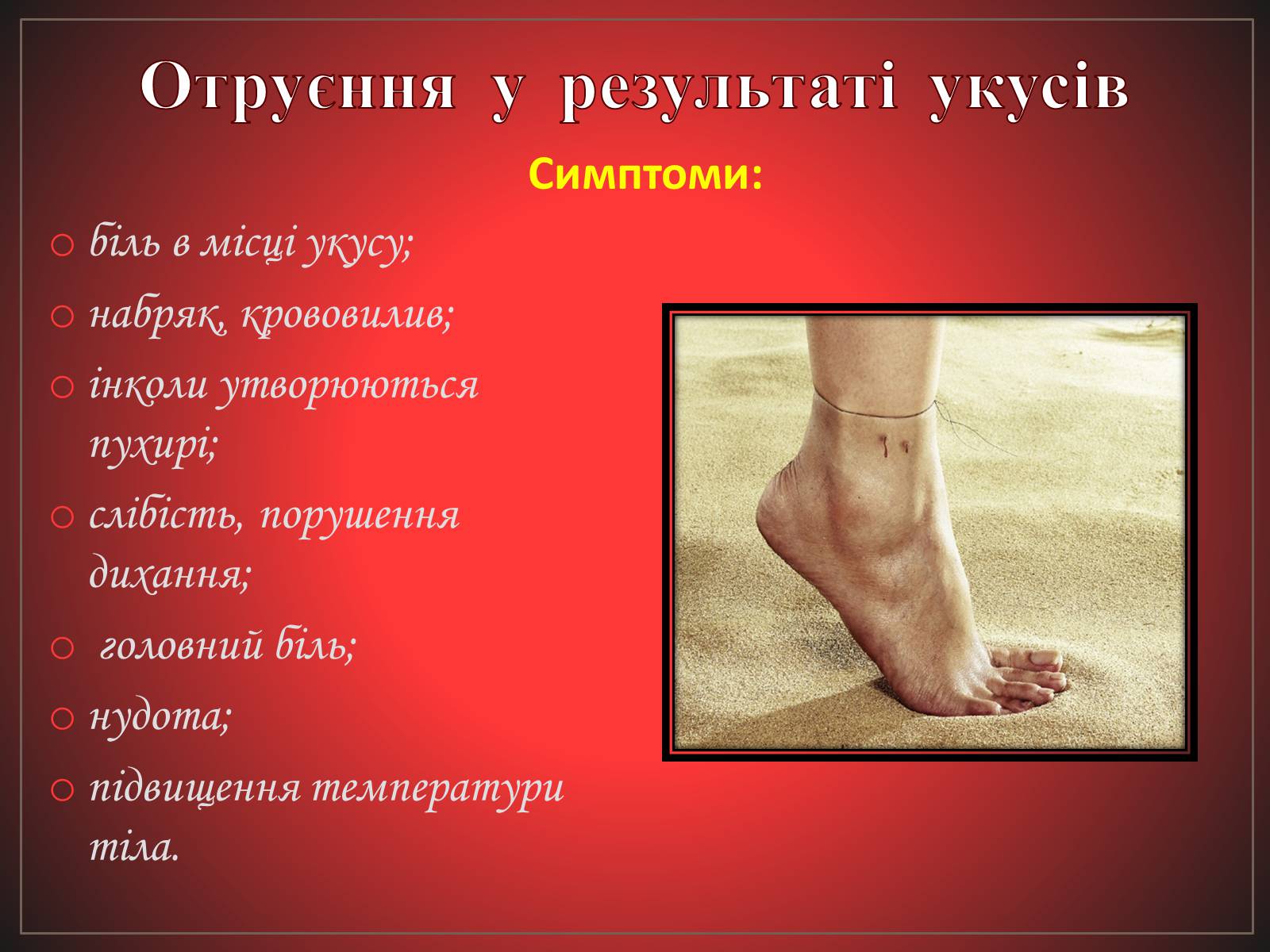 Презентація на тему «Перша допомога при отруєннях» (варіант 2) - Слайд #21 Презентація на тему «Перша допомога при отруєннях» (варіант 2) - Слайд #21
