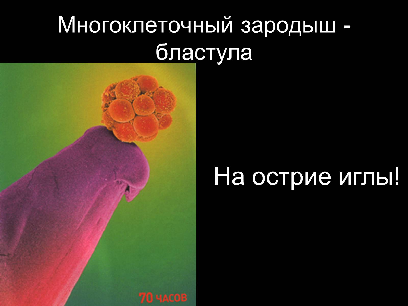 Презентація на тему «Половая система человека» (варіант 1) - Слайд #23 Презентація на тему «Половая система человека» (варіант 1) - Слайд #23