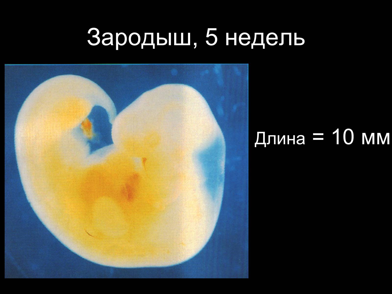 Презентація на тему «Половая система человека» (варіант 1) - Слайд #24 Презентація на тему «Половая система человека» (варіант 1) - Слайд #24