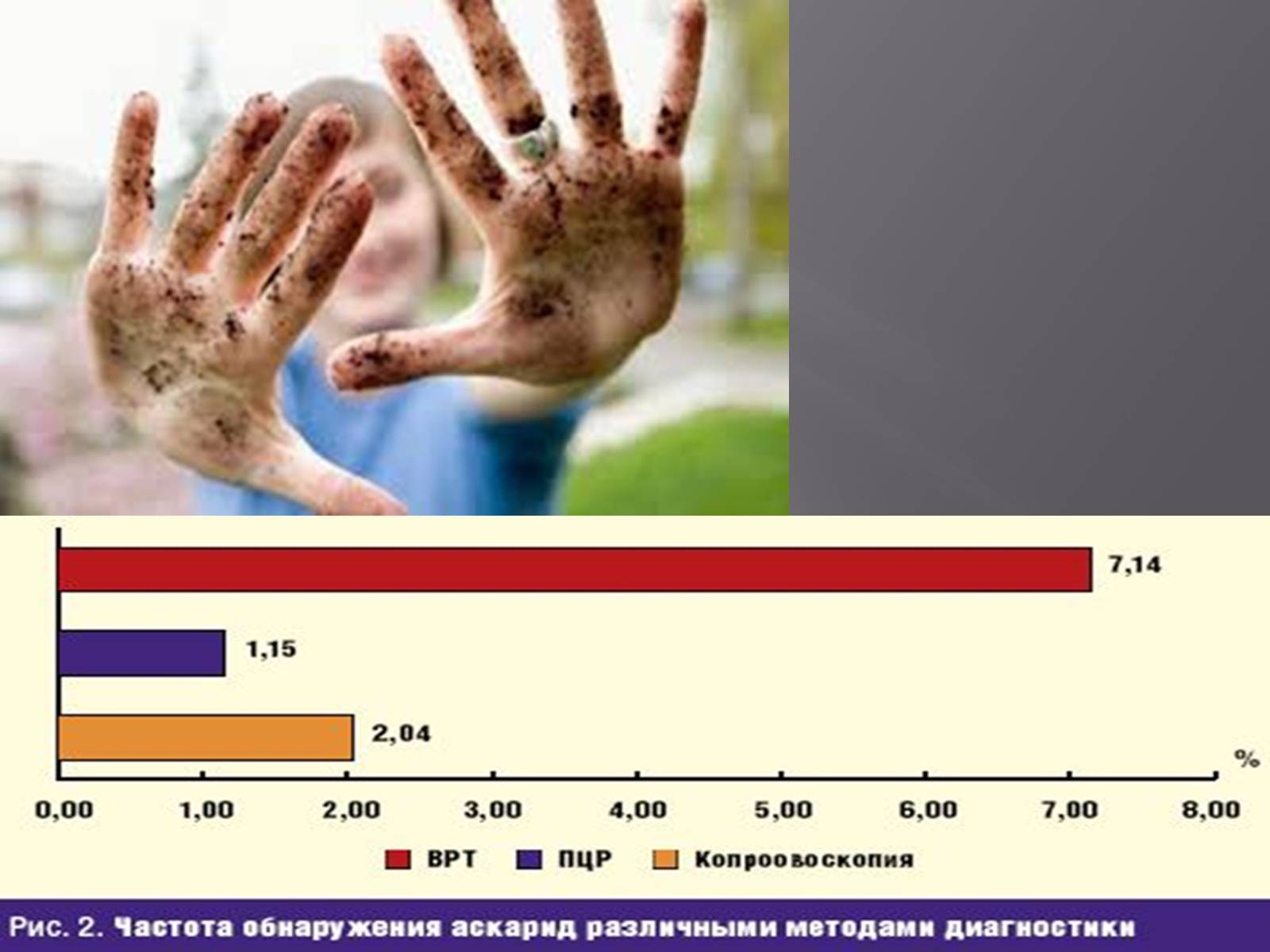 Презентація на тему «Аскариди» - Слайд #12 Презентація на тему «Аскариди» - Слайд #12