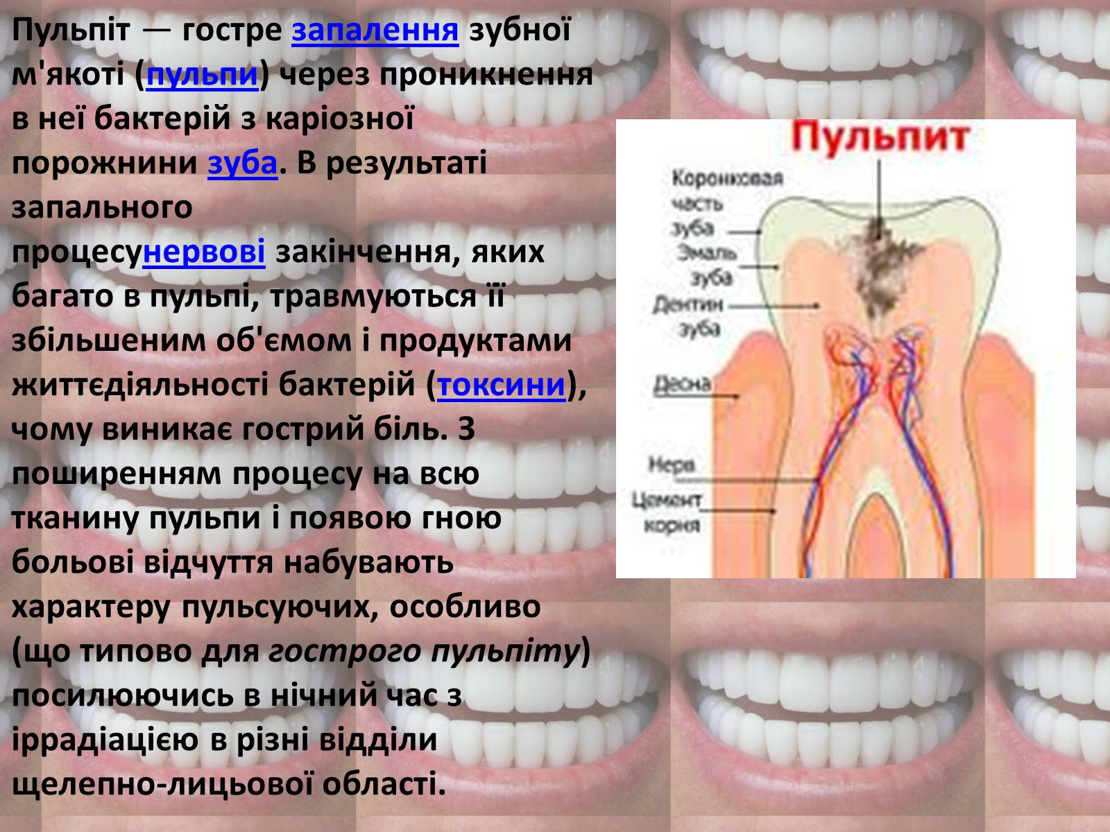 Презентація на тему «Зуби» (варіант 2) - Слайд #8 Презентація на тему «Зуби» (варіант 2) - Слайд #8
