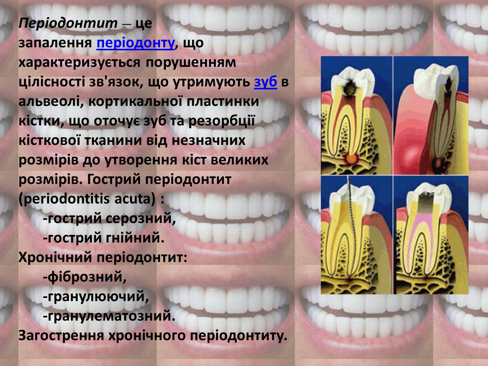 Презентація на тему «Зуби» (варіант 2) - Слайд #9 Презентація на тему «Зуби» (варіант 2) - Слайд #9