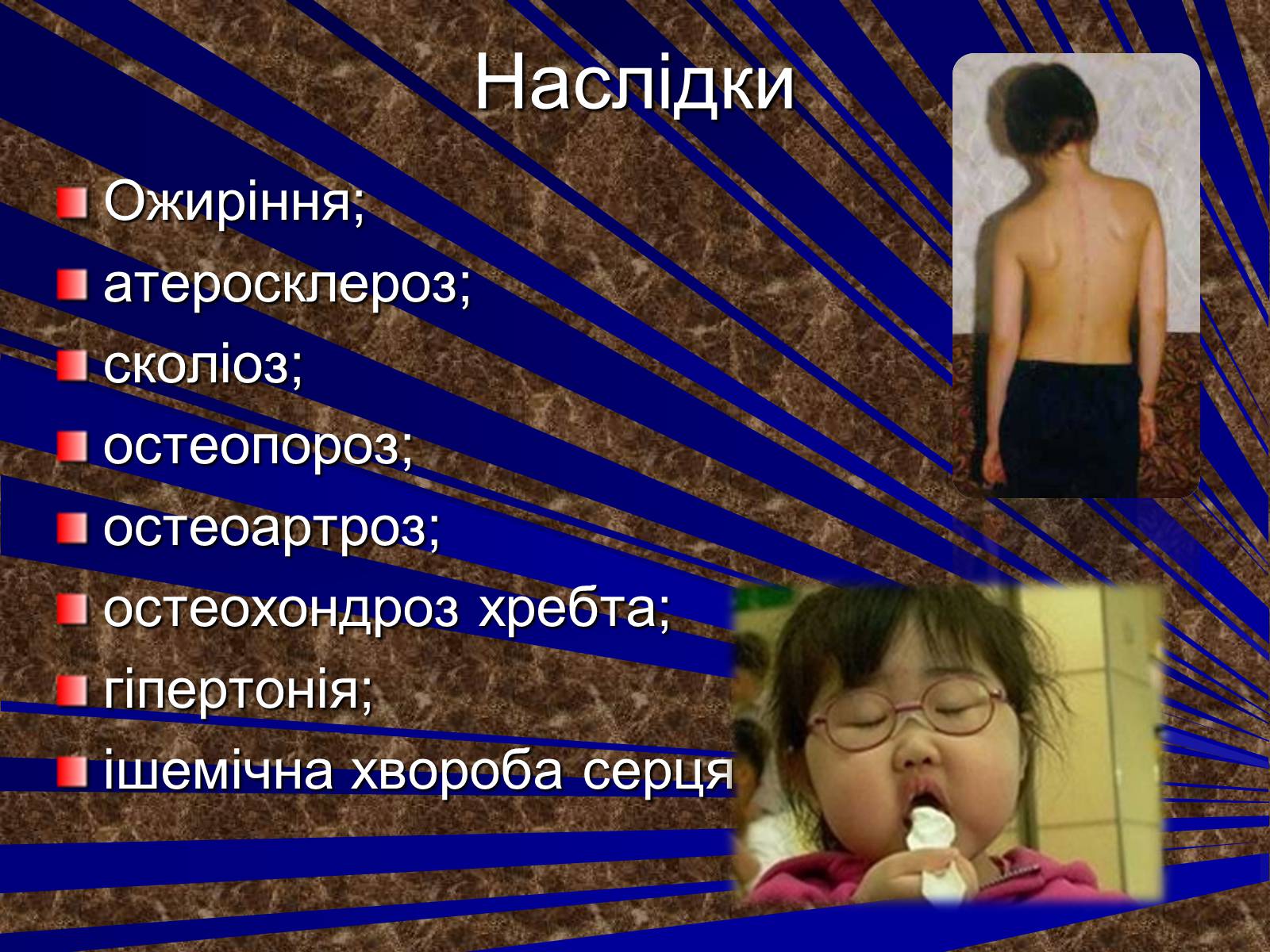 Презентація на тему «Гіподинамія» - Слайд #11 Презентація на тему «Гіподинамія» - Слайд #11