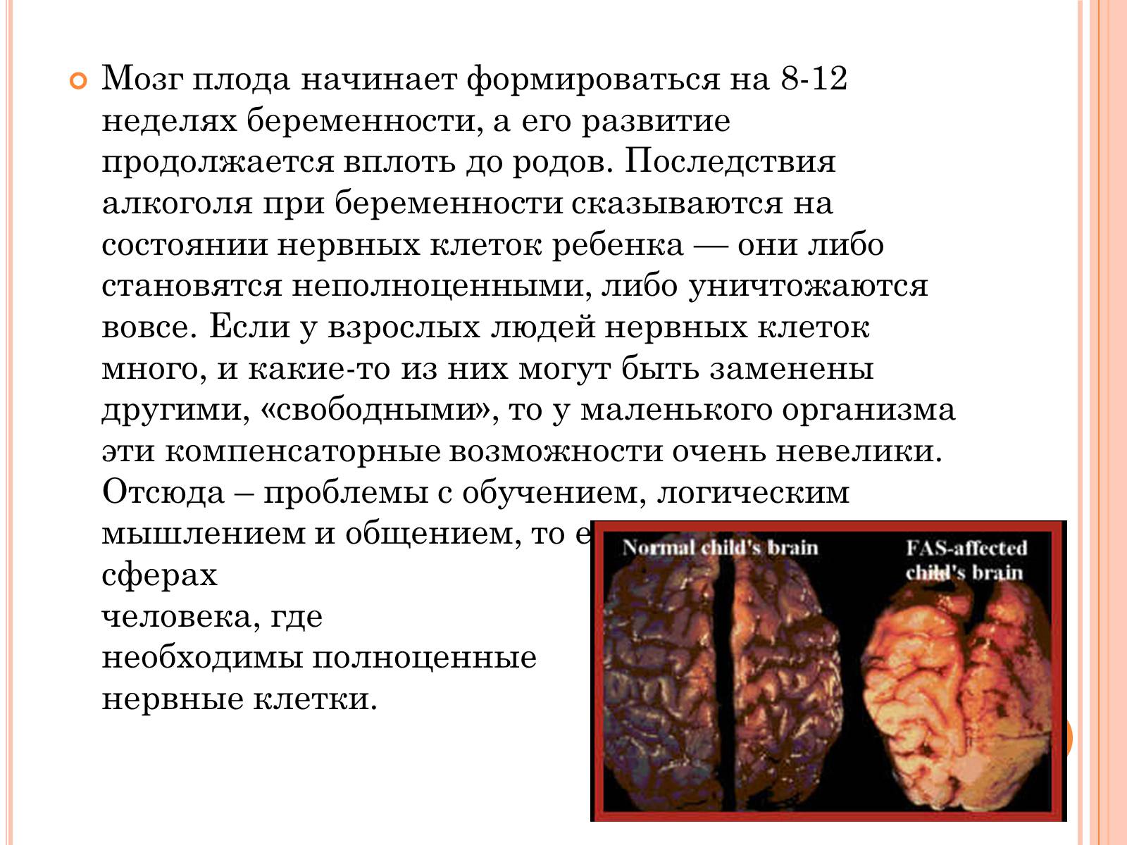 Презентація на тему «Беременность и алкоголь» - Слайд #15 Презентація на тему «Беременность и алкоголь» - Слайд #15