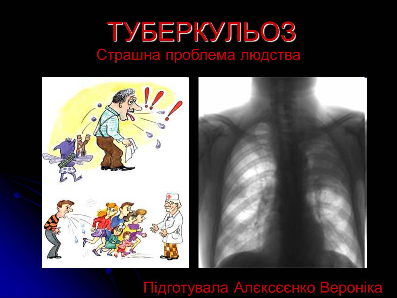 Презентація на тему «Туберкульоз» (варіант 4) - Слайд #1 Презентація на тему «Туберкульоз» (варіант 4) - Слайд #1