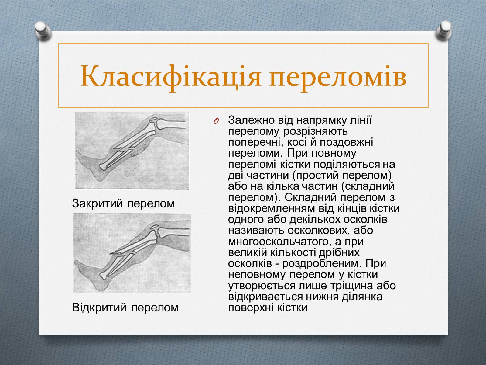 Презентація на тему «Травми та перша допомога при них» - Слайд #6 Презентація на тему «Травми та перша допомога при них» - Слайд #6