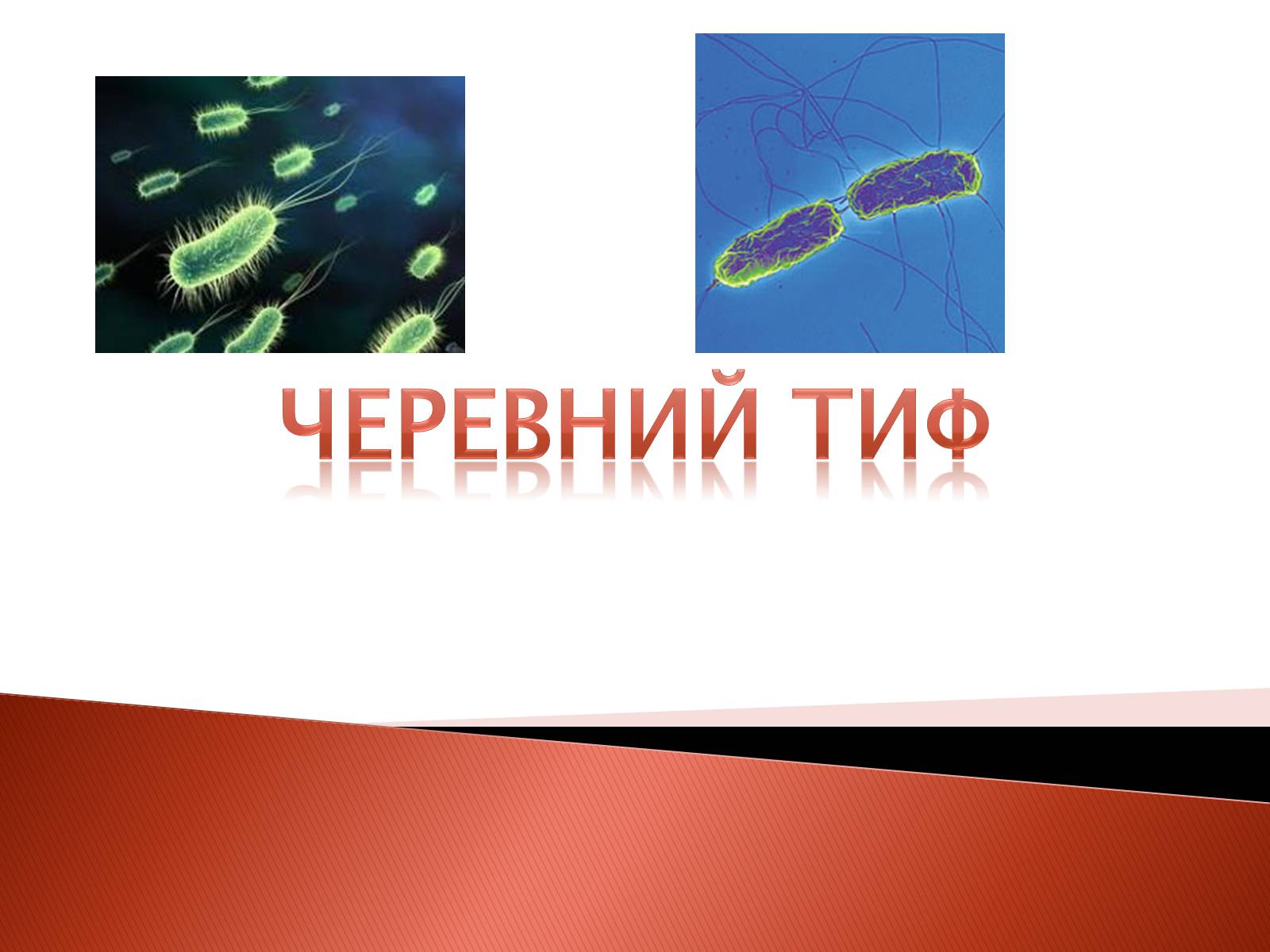 Презентація на тему «Черевний тиф» - Слайд #1 Презентація на тему «Черевний тиф» - Слайд #1