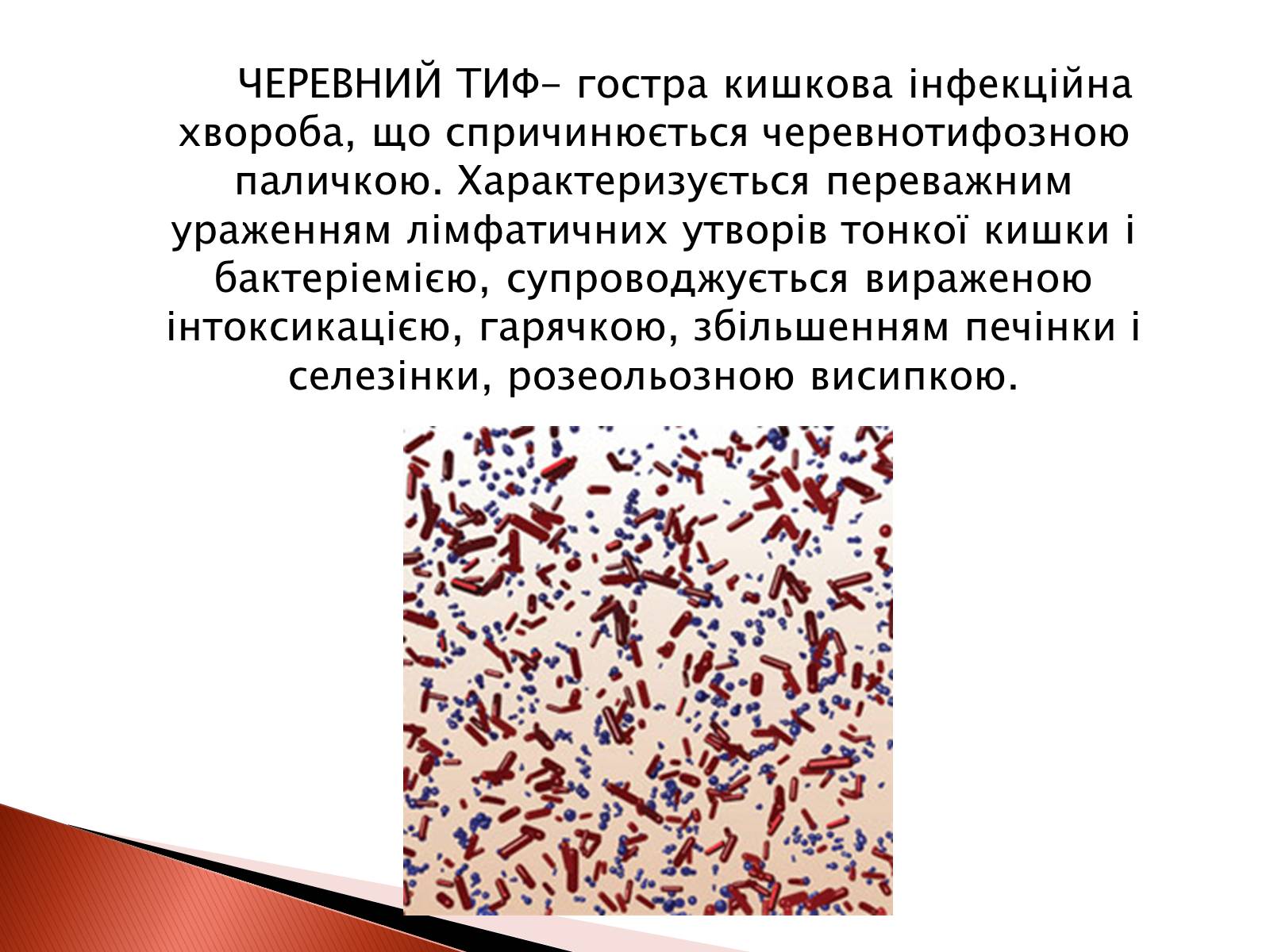 Презентація на тему «Черевний тиф» - Слайд #2 Презентація на тему «Черевний тиф» - Слайд #2