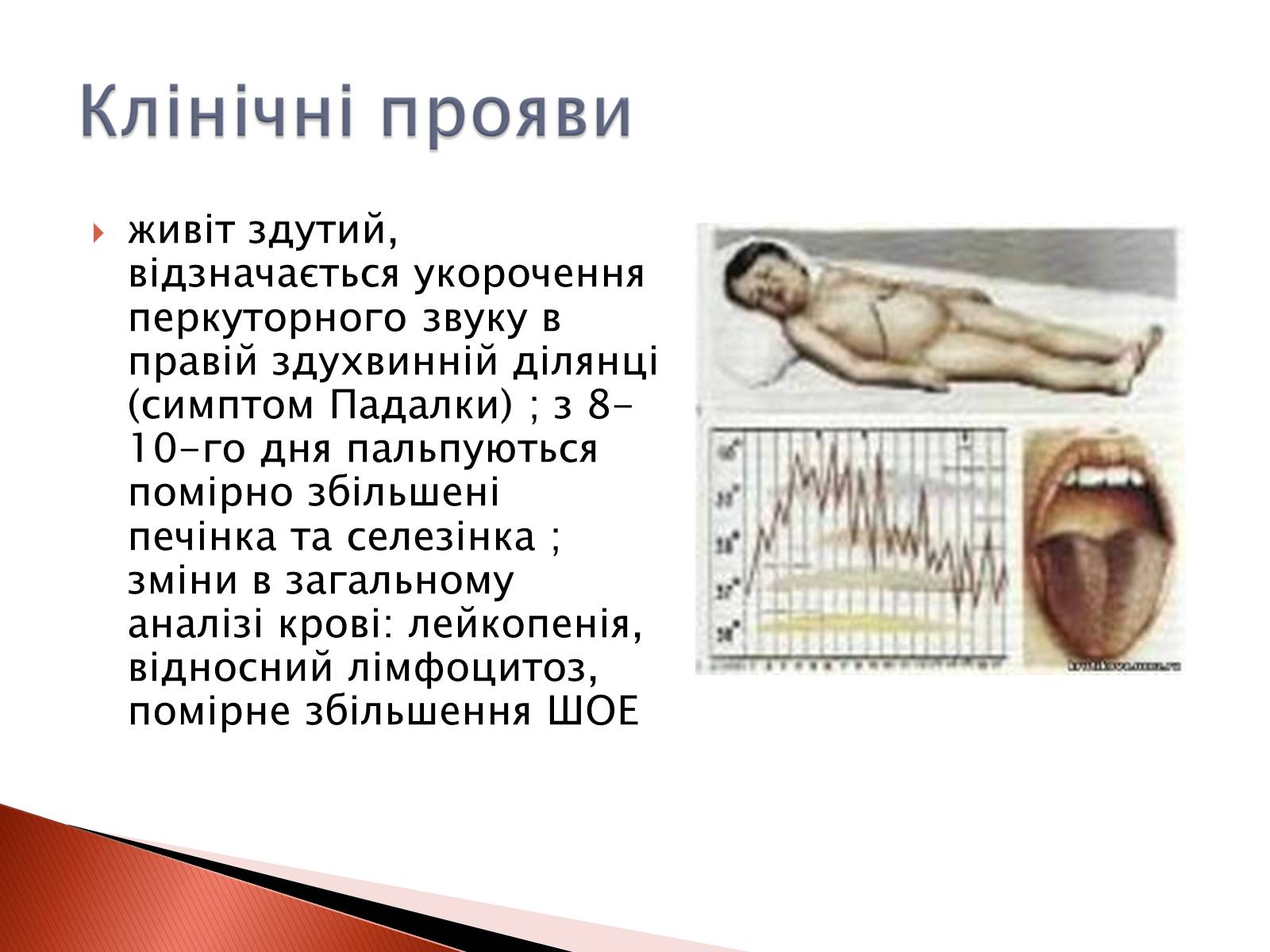Презентація на тему «Черевний тиф» - Слайд #8 Презентація на тему «Черевний тиф» - Слайд #8