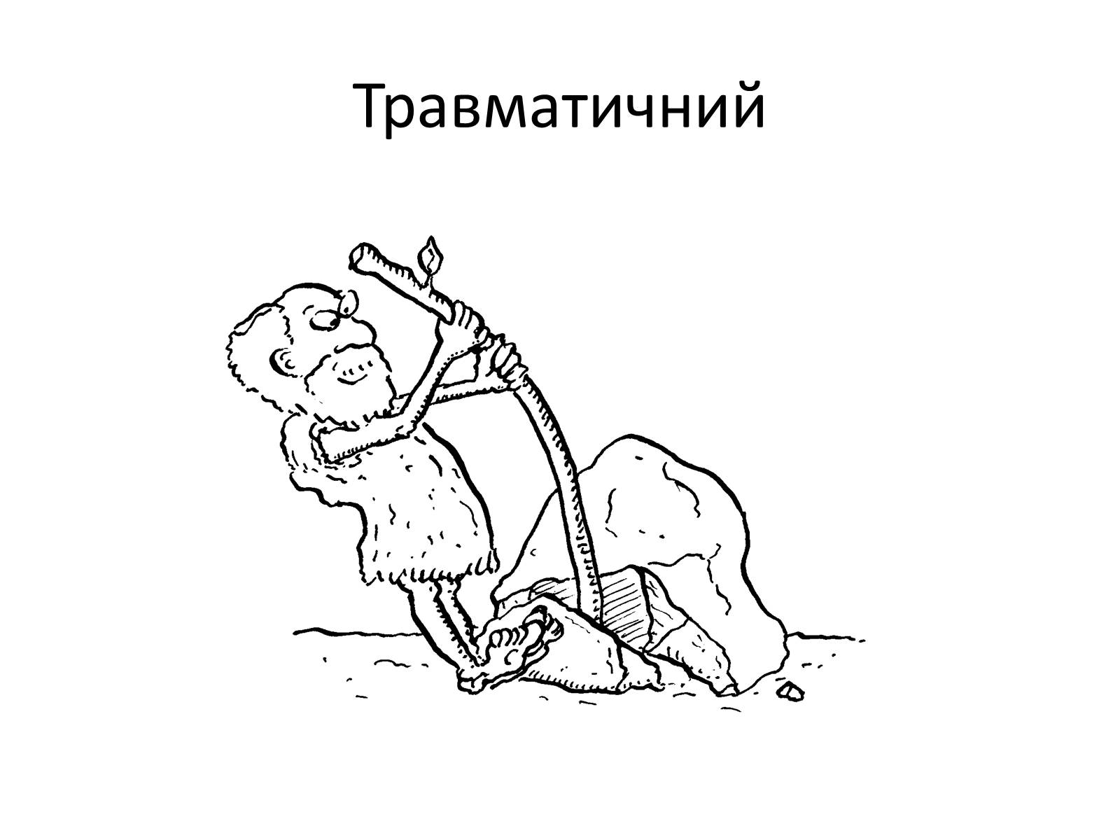 Презентація на тему «Переломи та вивихи. Перша допомога» - Слайд #3 Презентація на тему «Переломи та вивихи. Перша допомога» - Слайд #3