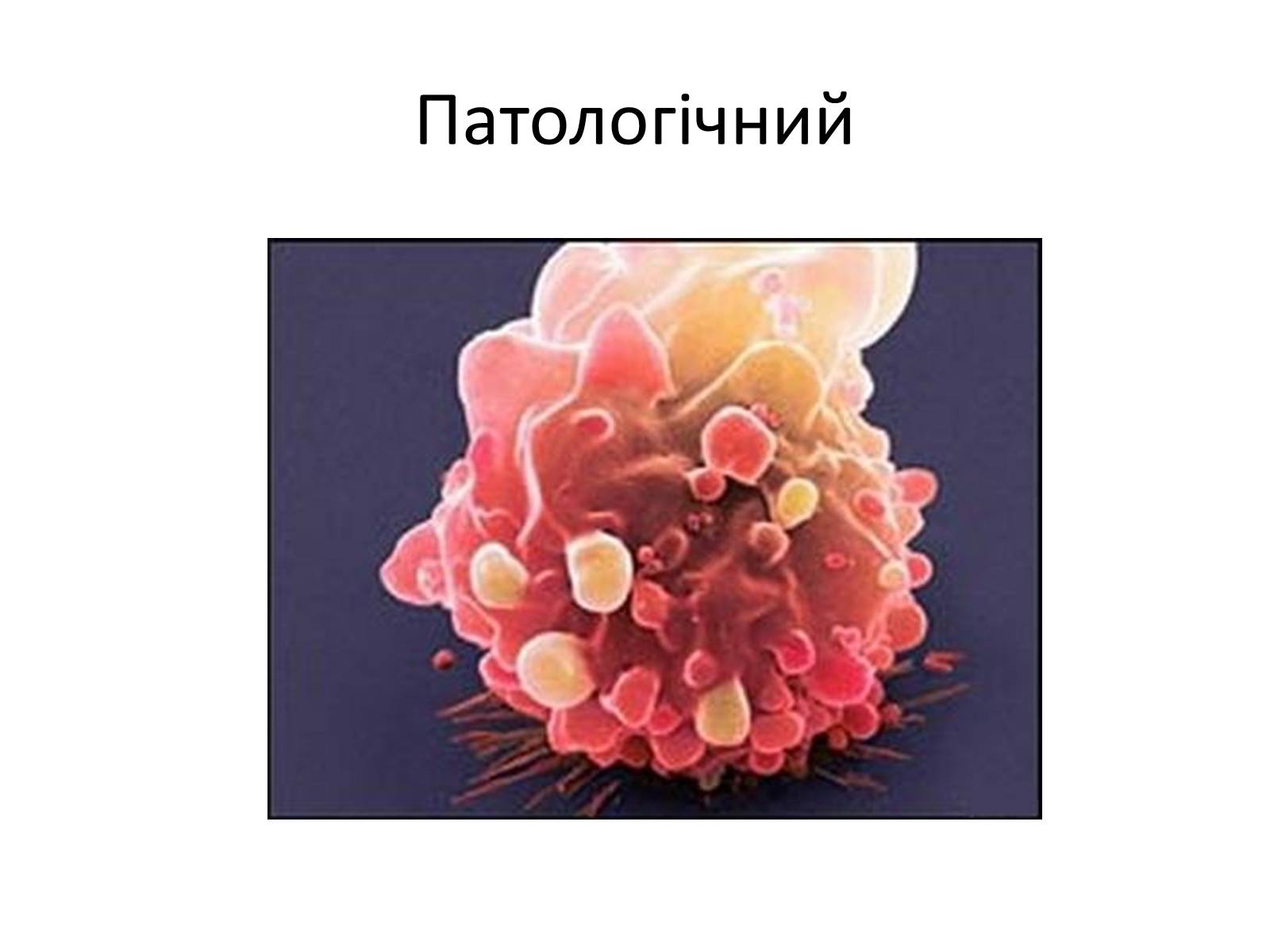 Презентація на тему «Переломи та вивихи. Перша допомога» - Слайд #4 Презентація на тему «Переломи та вивихи. Перша допомога» - Слайд #4