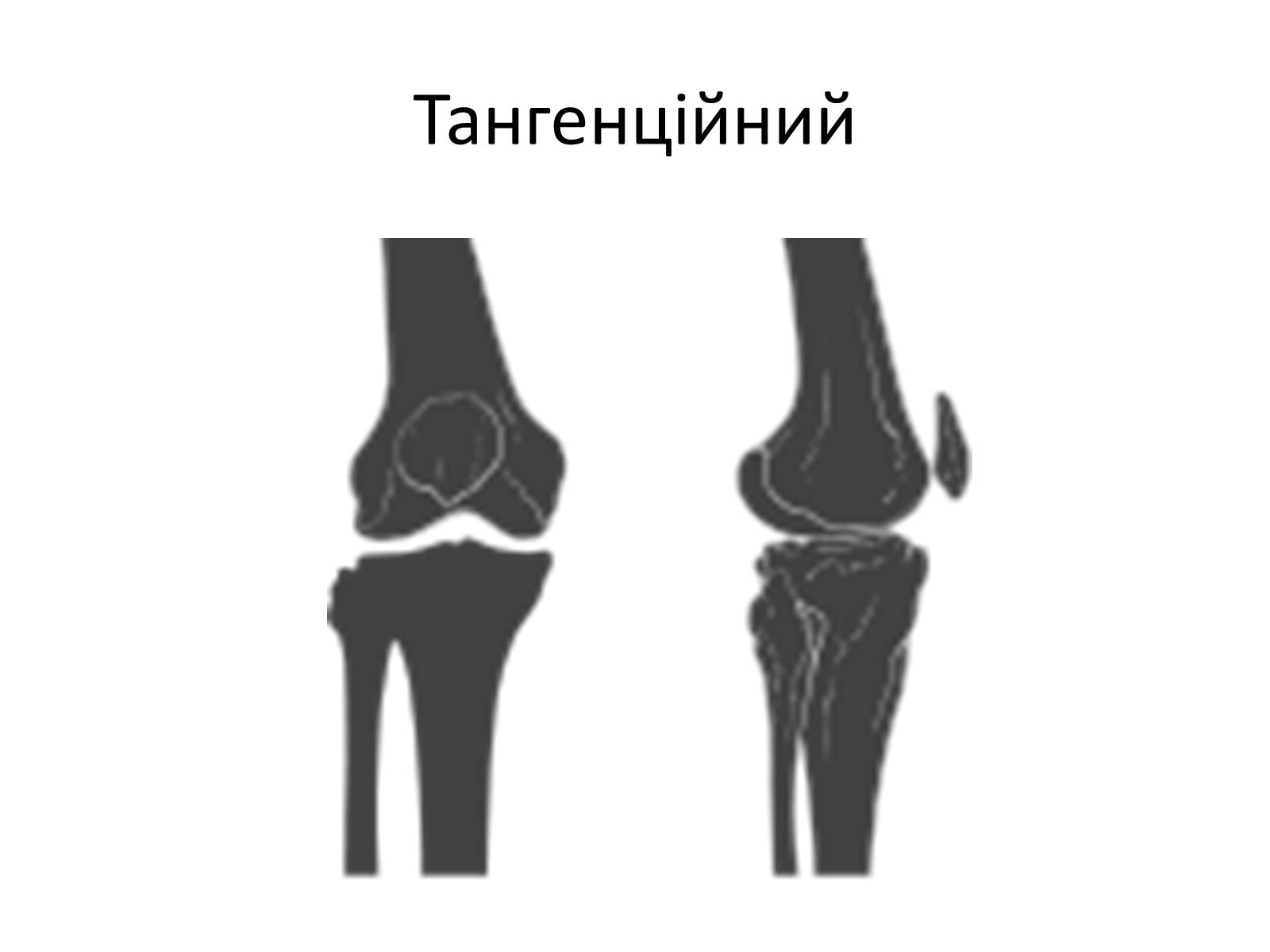 Презентація на тему «Переломи та вивихи. Перша допомога» - Слайд #5 Презентація на тему «Переломи та вивихи. Перша допомога» - Слайд #5