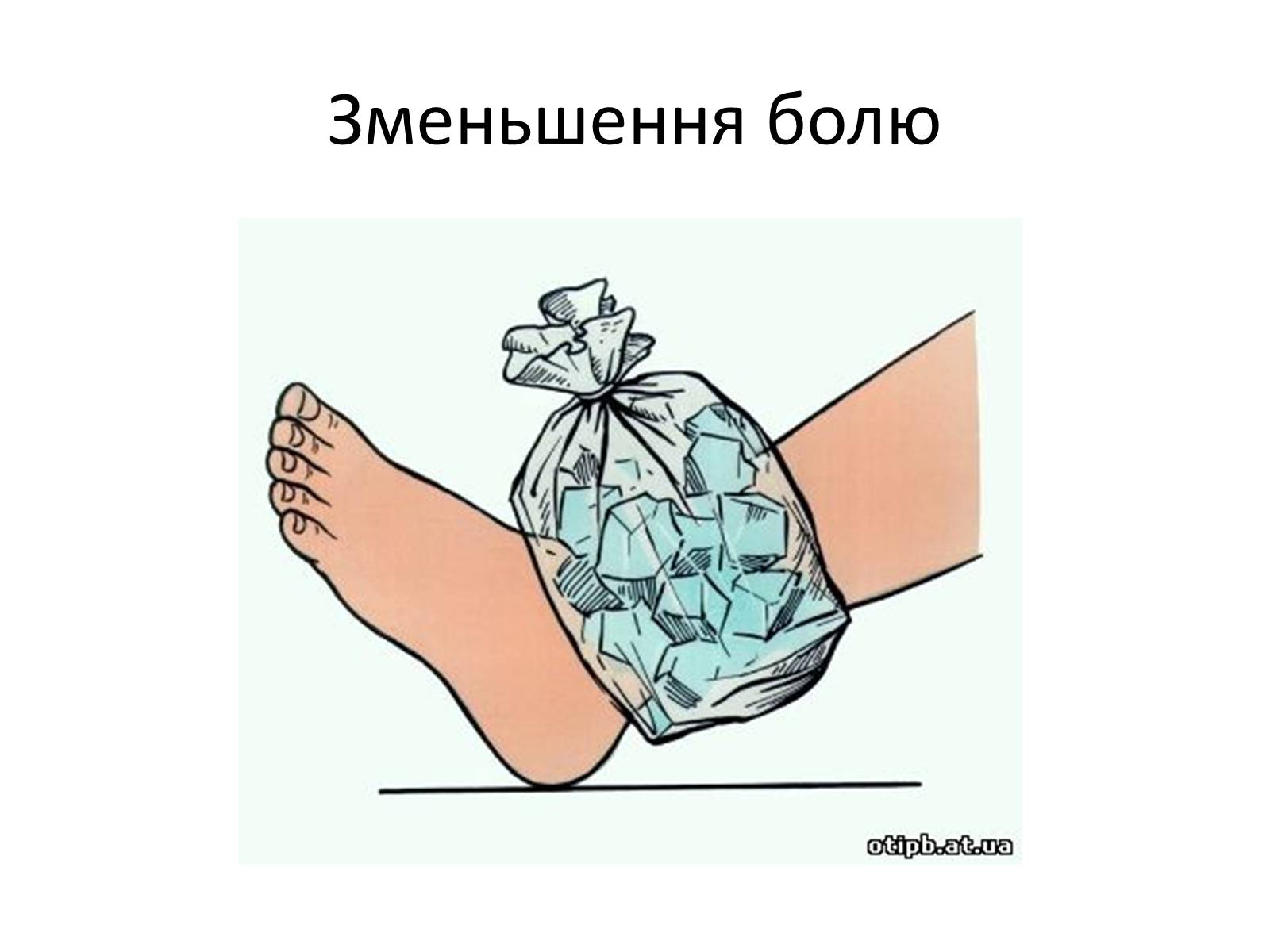 Презентація на тему «Переломи та вивихи. Перша допомога» - Слайд #7 Презентація на тему «Переломи та вивихи. Перша допомога» - Слайд #7