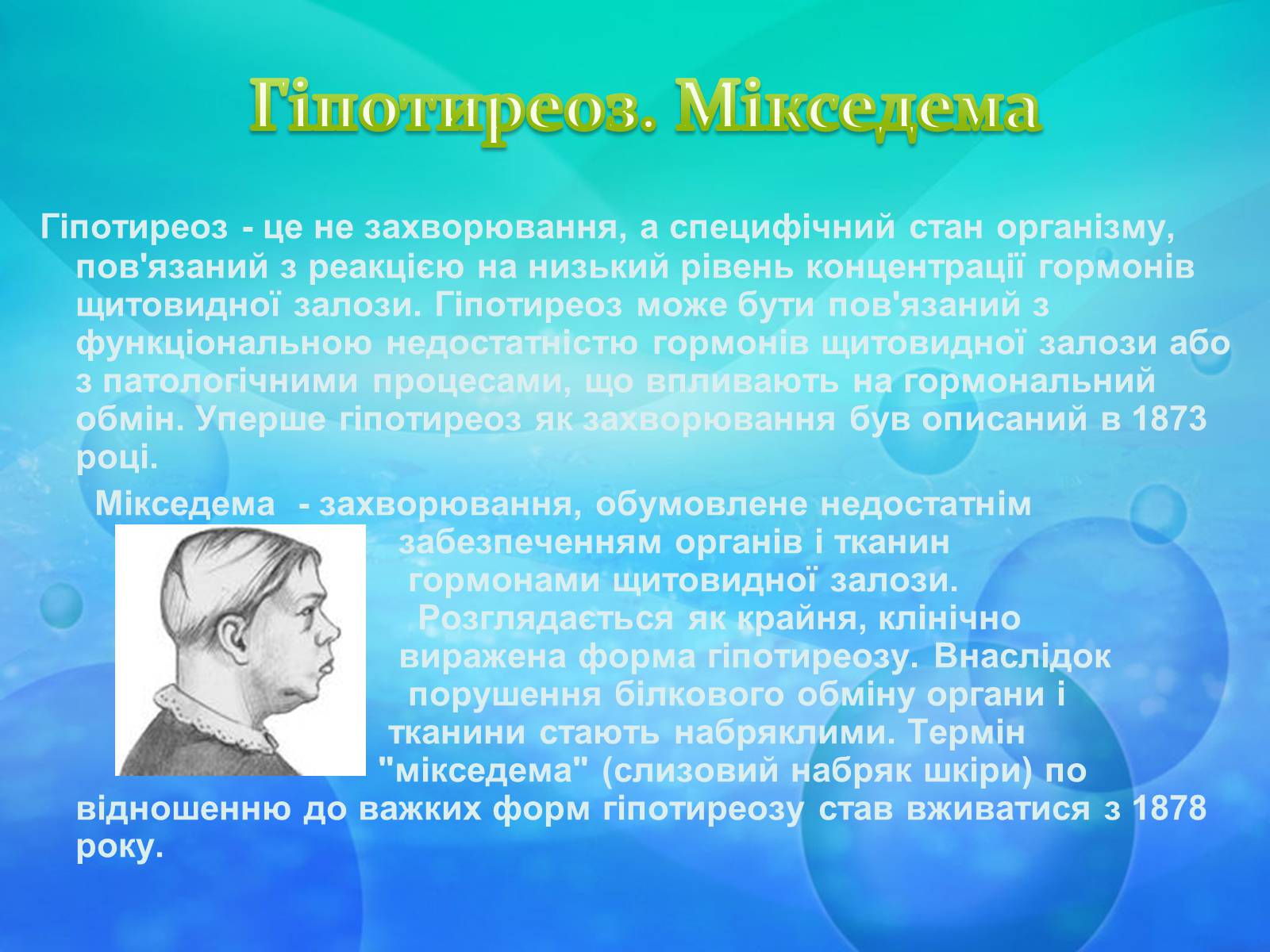 Презентація на тему «Щитоподібна залоза» - Слайд #6 Презентація на тему «Щитоподібна залоза» - Слайд #6