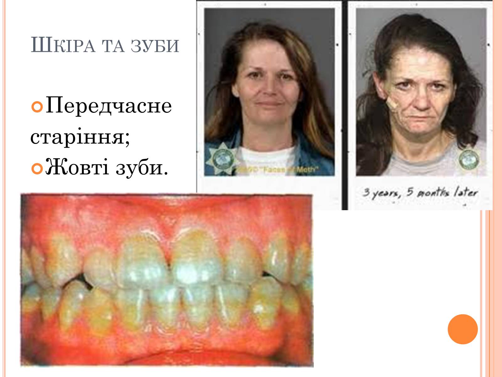 Презентація на тему «Шкода паління» - Слайд #12 Презентація на тему «Шкода паління» - Слайд #12