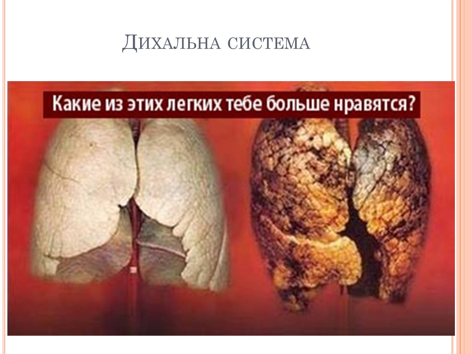Презентація на тему «Шкода паління» - Слайд #8 Презентація на тему «Шкода паління» - Слайд #8