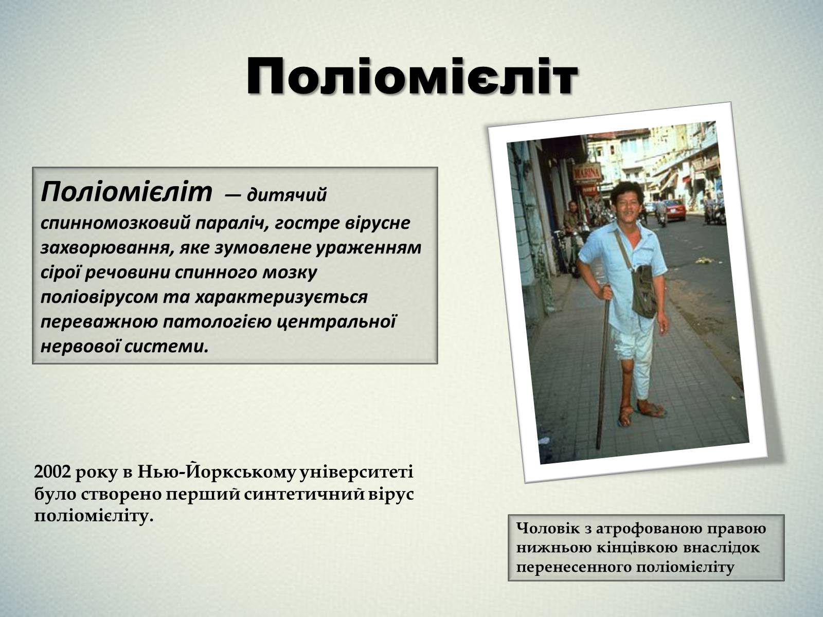 Презентація на тему «Найбільші епідемії та пандемії» - Слайд #7 Презентація на тему «Найбільші епідемії та пандемії» - Слайд #7