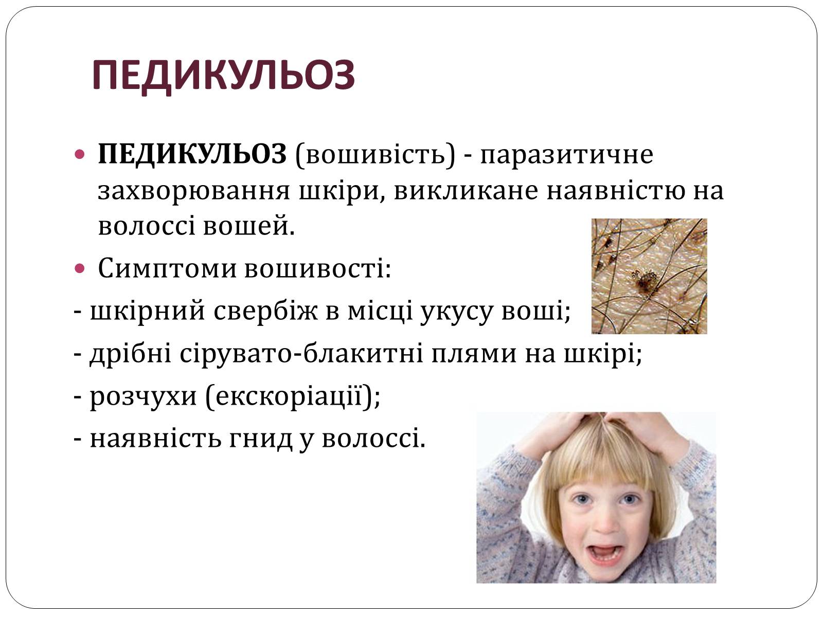 Презентація на тему «Шкіра» (варіант 2) - Слайд #11 Презентація на тему «Шкіра» (варіант 2) - Слайд #11