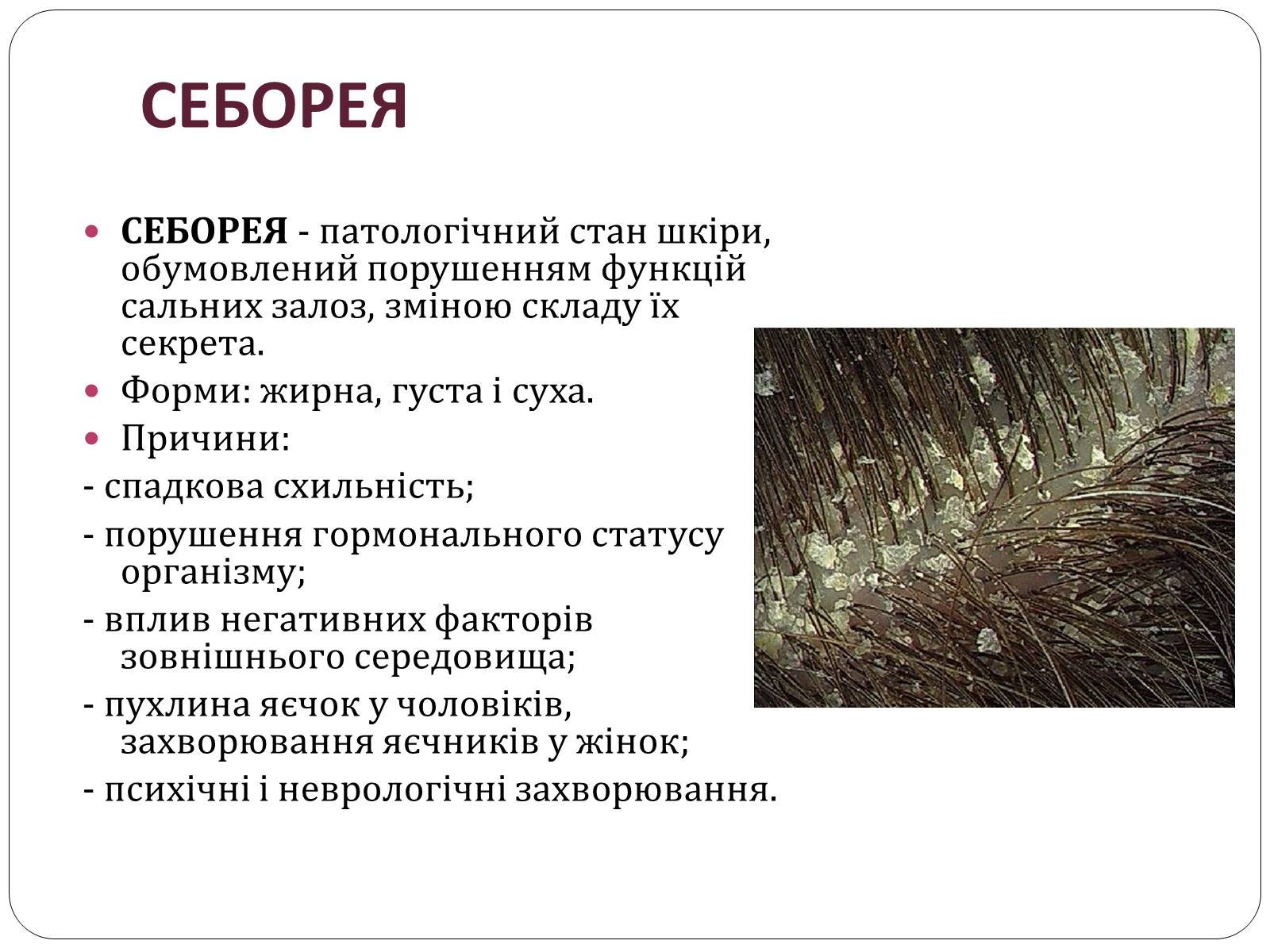 Презентація на тему «Шкіра» (варіант 2) - Слайд #13 Презентація на тему «Шкіра» (варіант 2) - Слайд #13