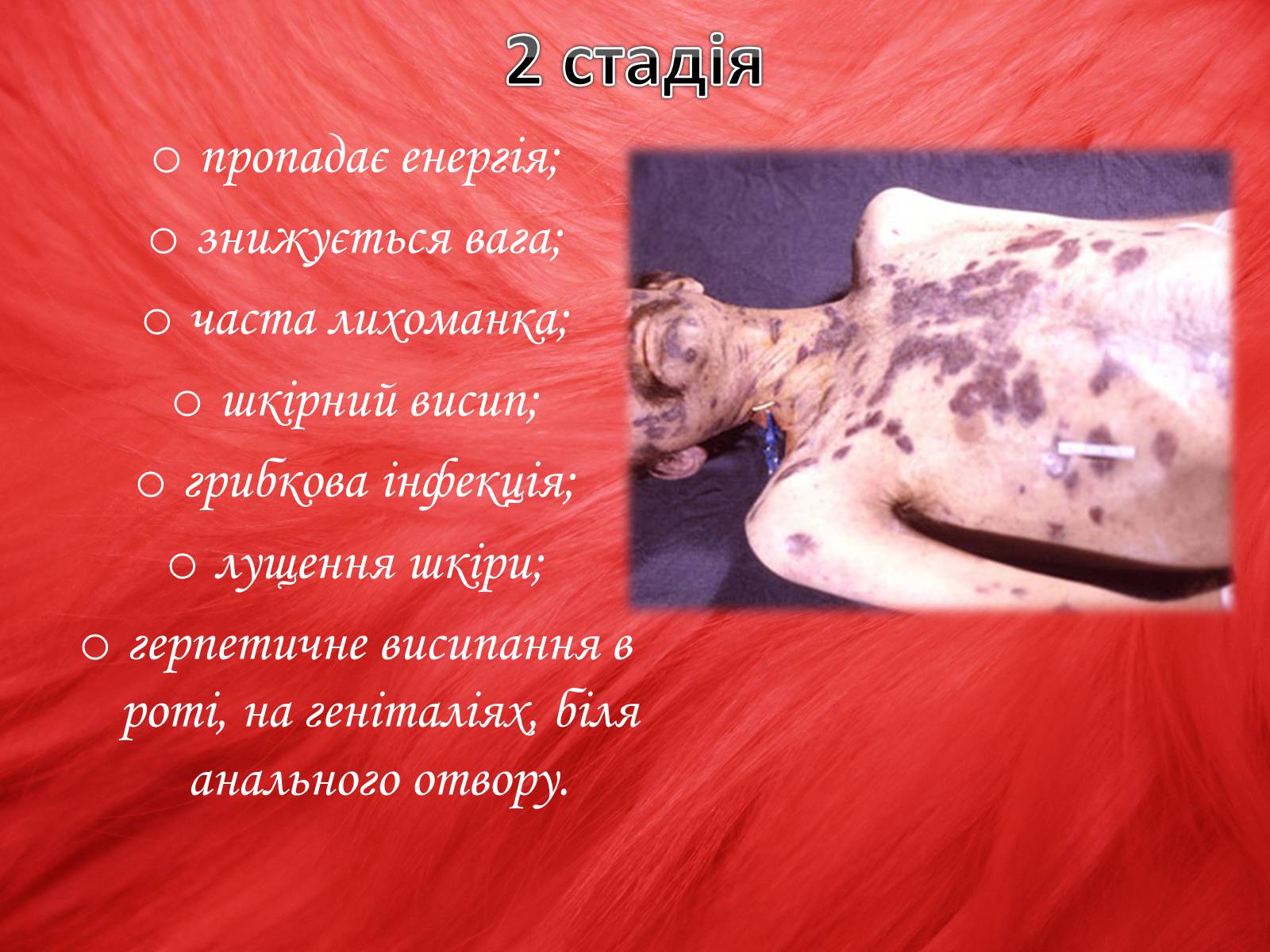 Презентація на тему «Профілактика ВІЛ/СНІДу» - Слайд #10 Презентація на тему «Профілактика ВІЛ/СНІДу» - Слайд #10