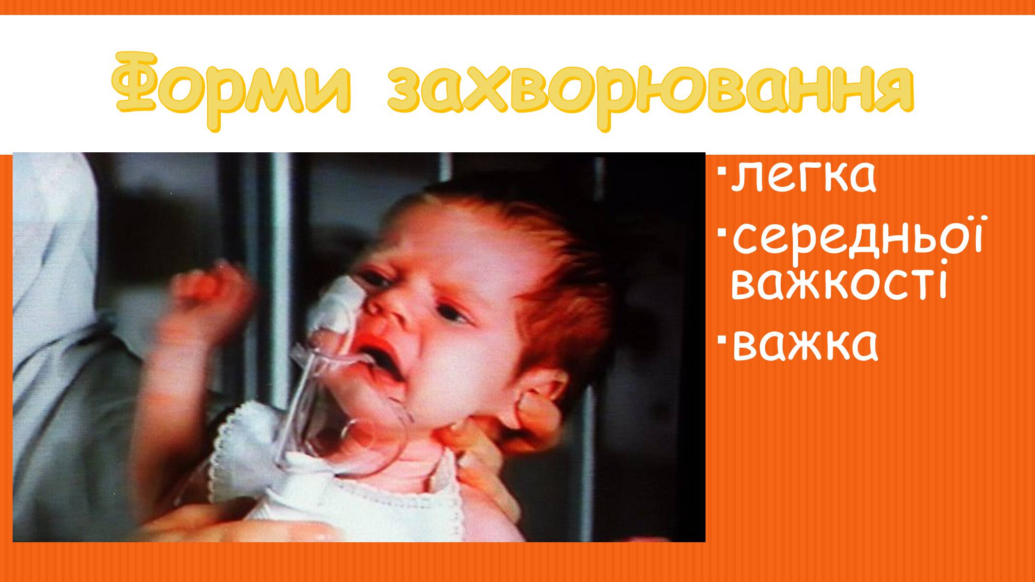 Презентація на тему «Коклюш» - Слайд #6 Презентація на тему «Коклюш» - Слайд #6