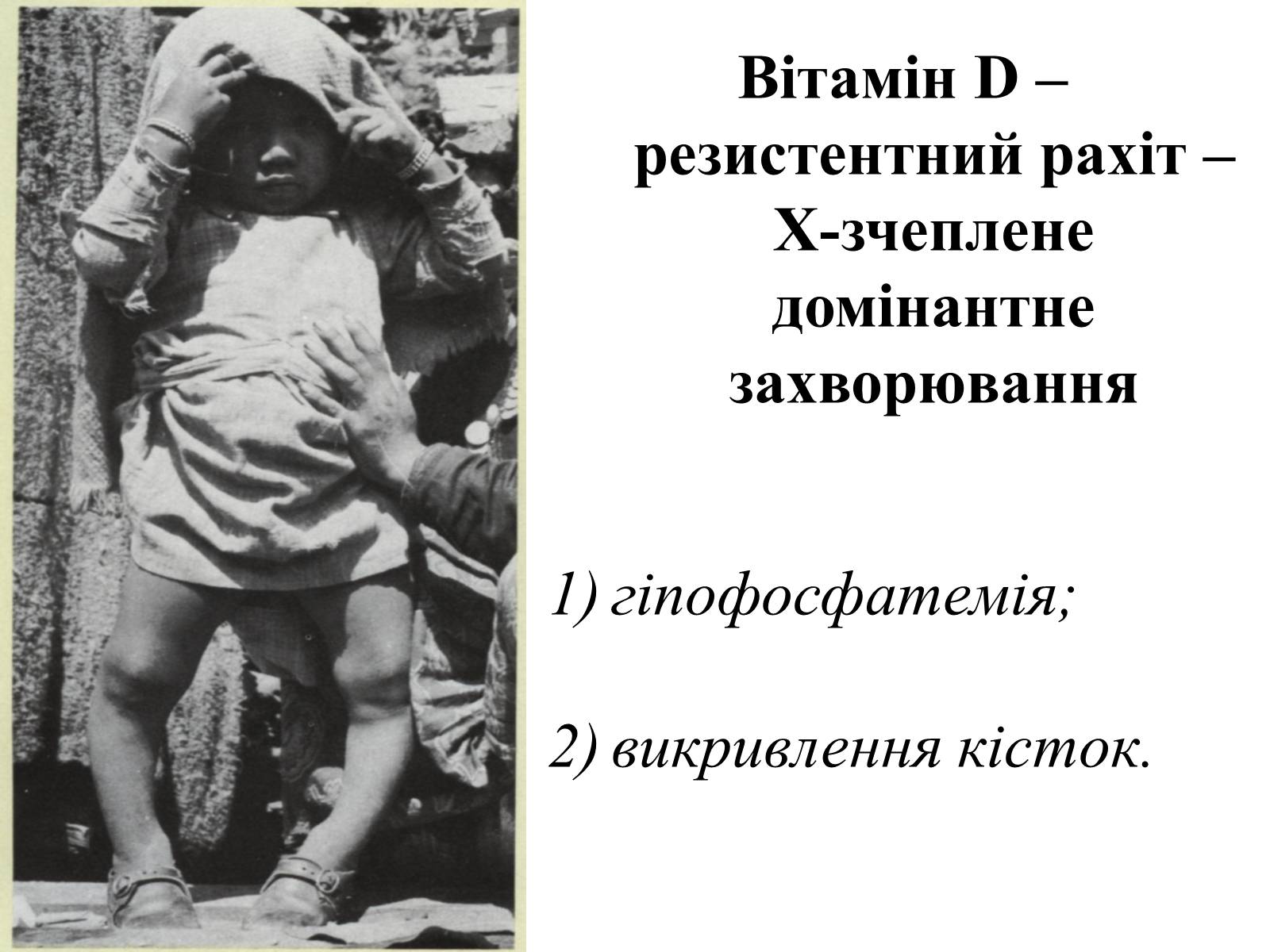 Презентація на тему «Успадкування статі та ознак, зчеплених зі статтю» - Слайд #27 Презентація на тему «Успадкування статі та ознак, зчеплених зі статтю» - Слайд #27